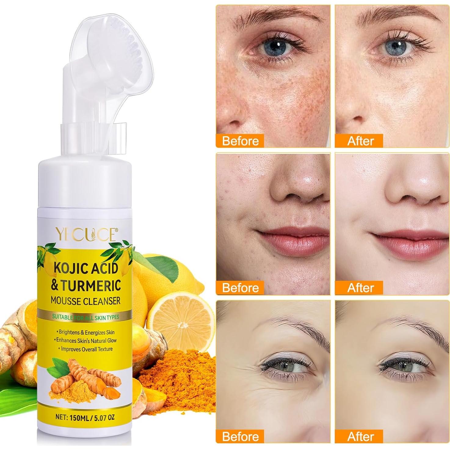 Mousse Limpiador Facial de Cúrcuma 150ML - Piel Suave y Hidratada