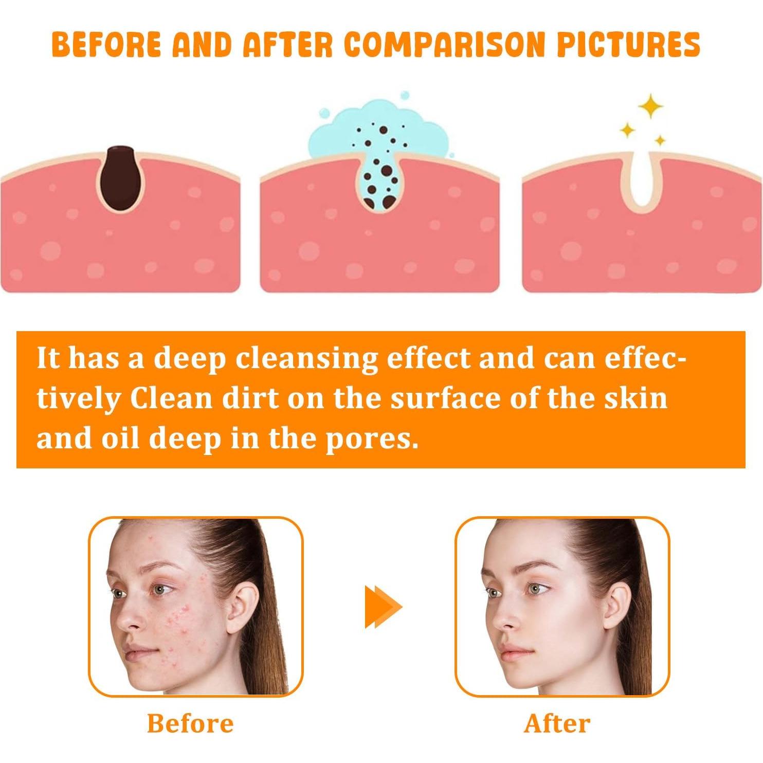 Limpiador Facial de Cúrcuma Natural 100 ml - Todo Tipo de Piel