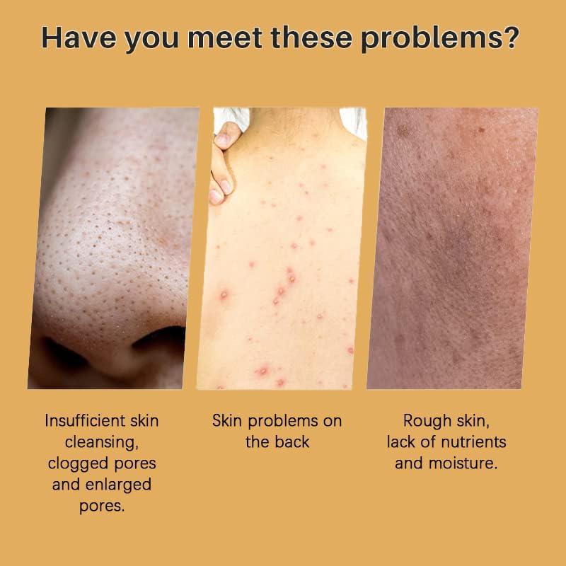 Juego de Cuidado Facial Deuiosna con Jabón y Limpiador de Cúrcuma