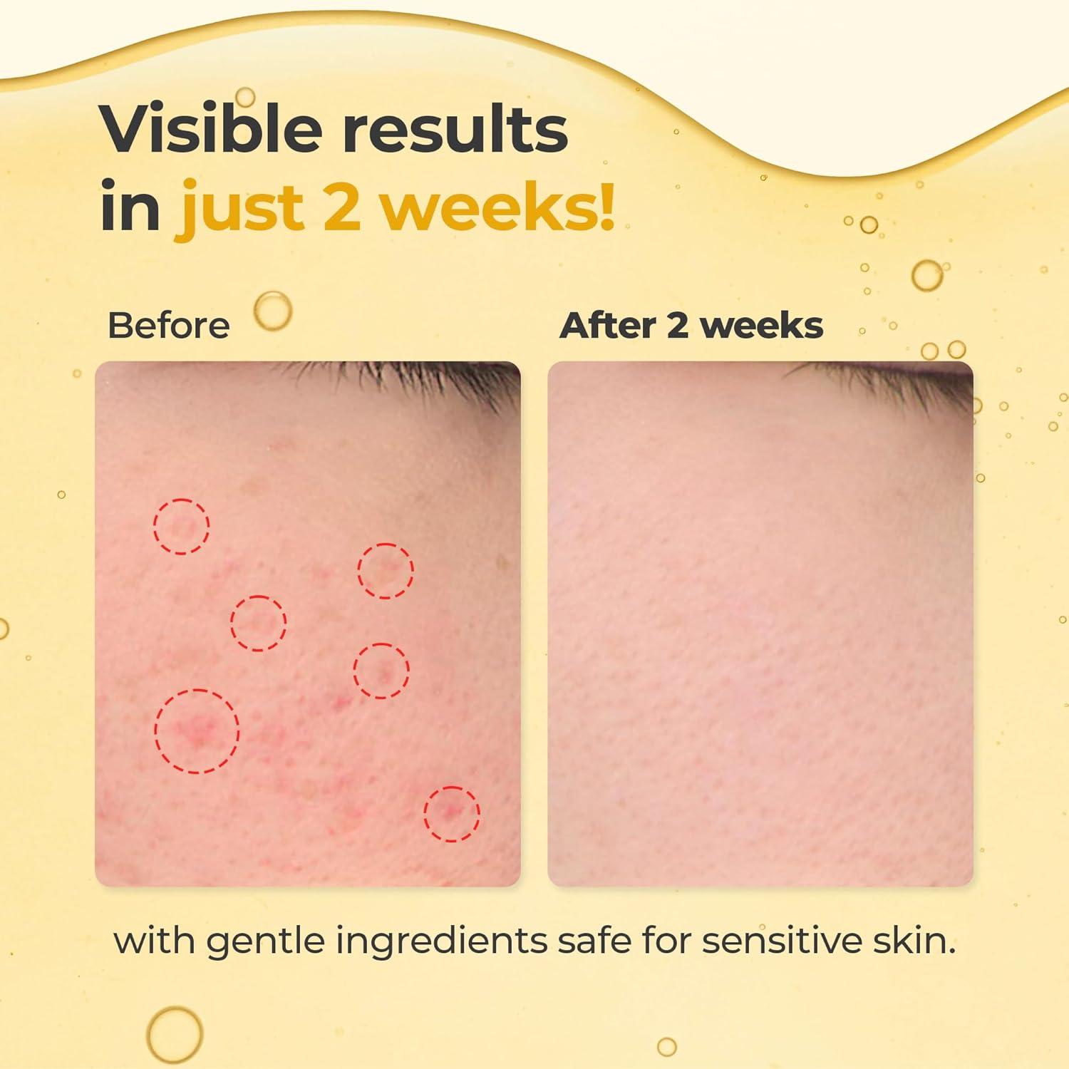 Suero Glutatión Even & Glow BNB Corea 132g Piel Radiante