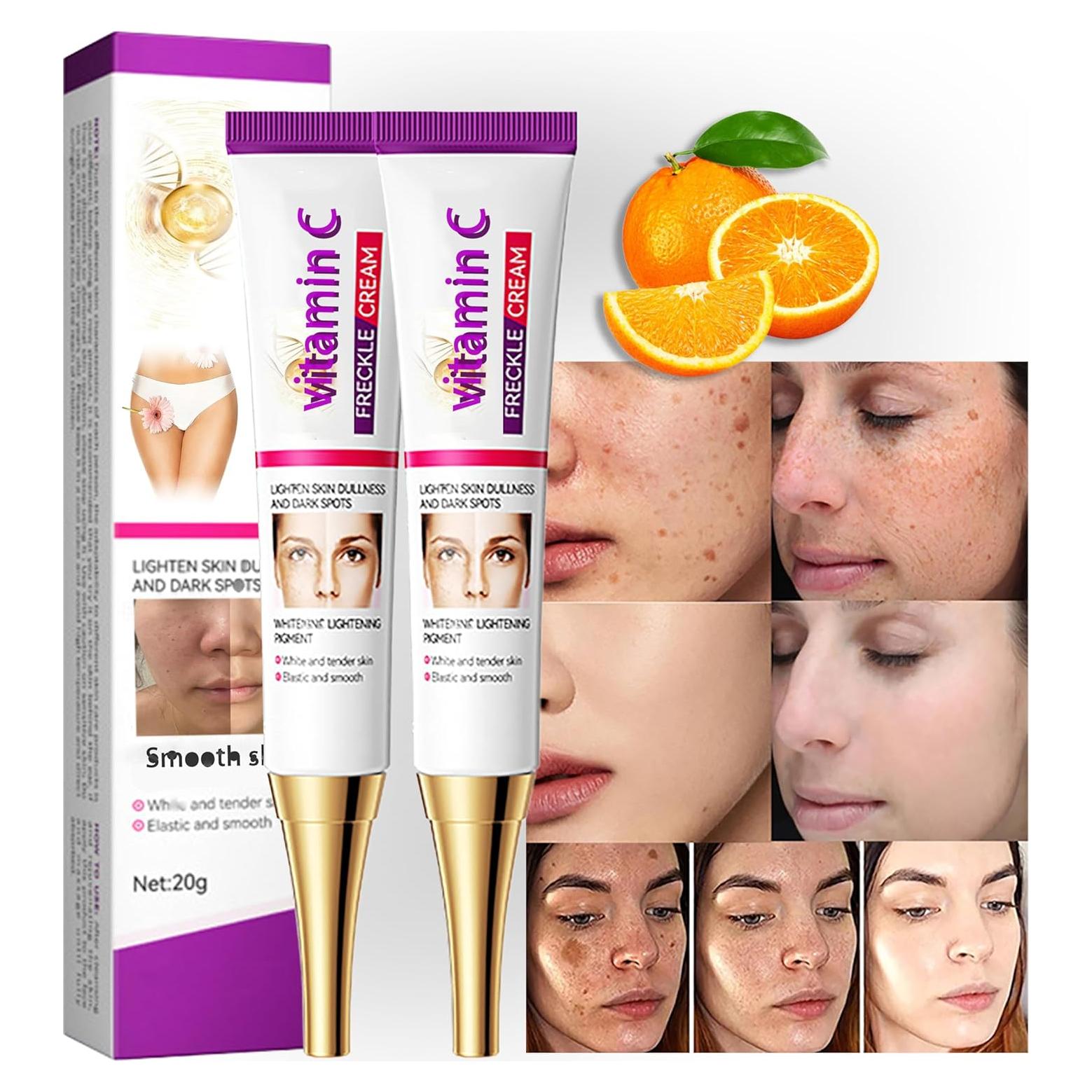 Crema de Niacinamida Natural 20g para Manchas Oscuras y Melasma