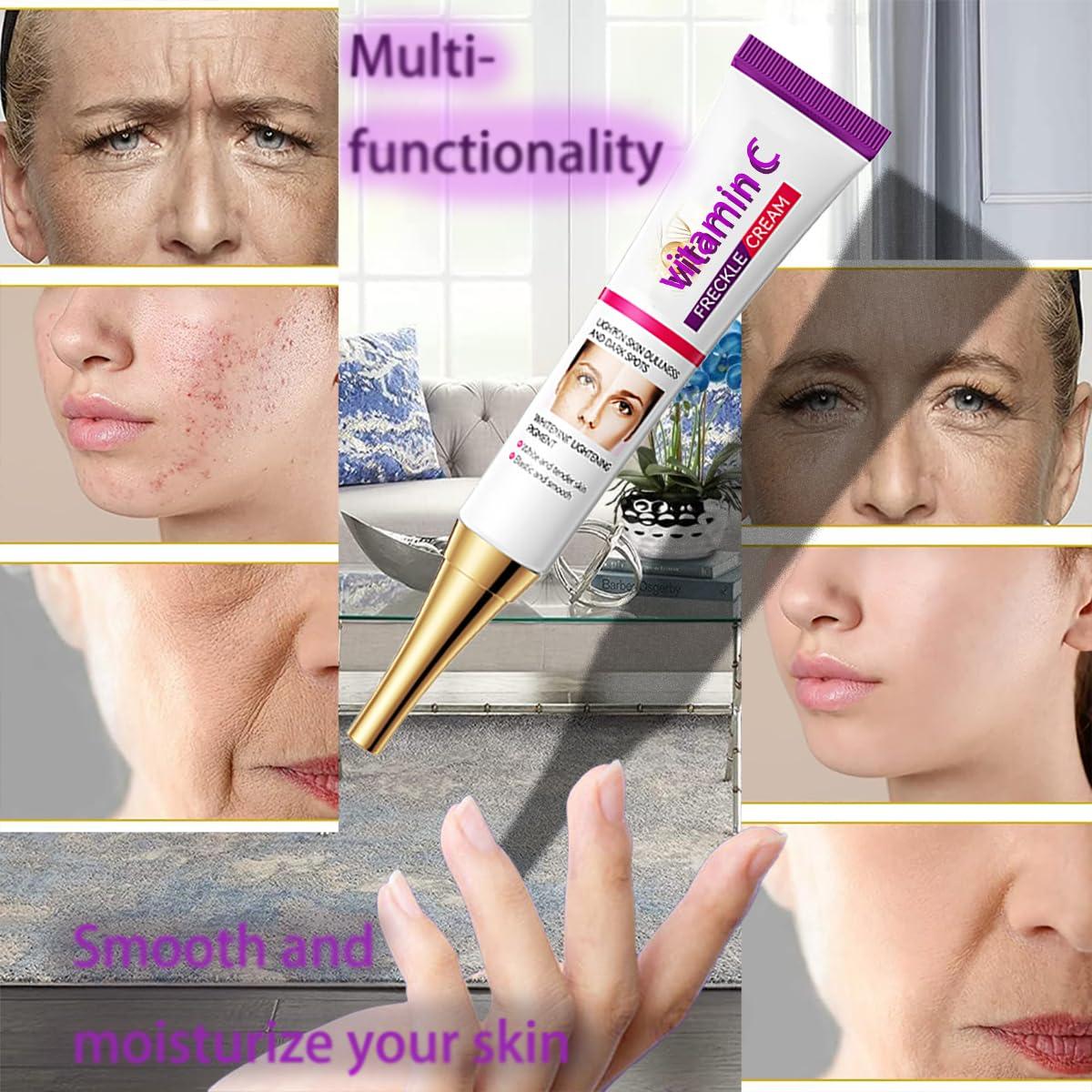 Crema de Niacinamida Natural 20g para Manchas Oscuras y Melasma