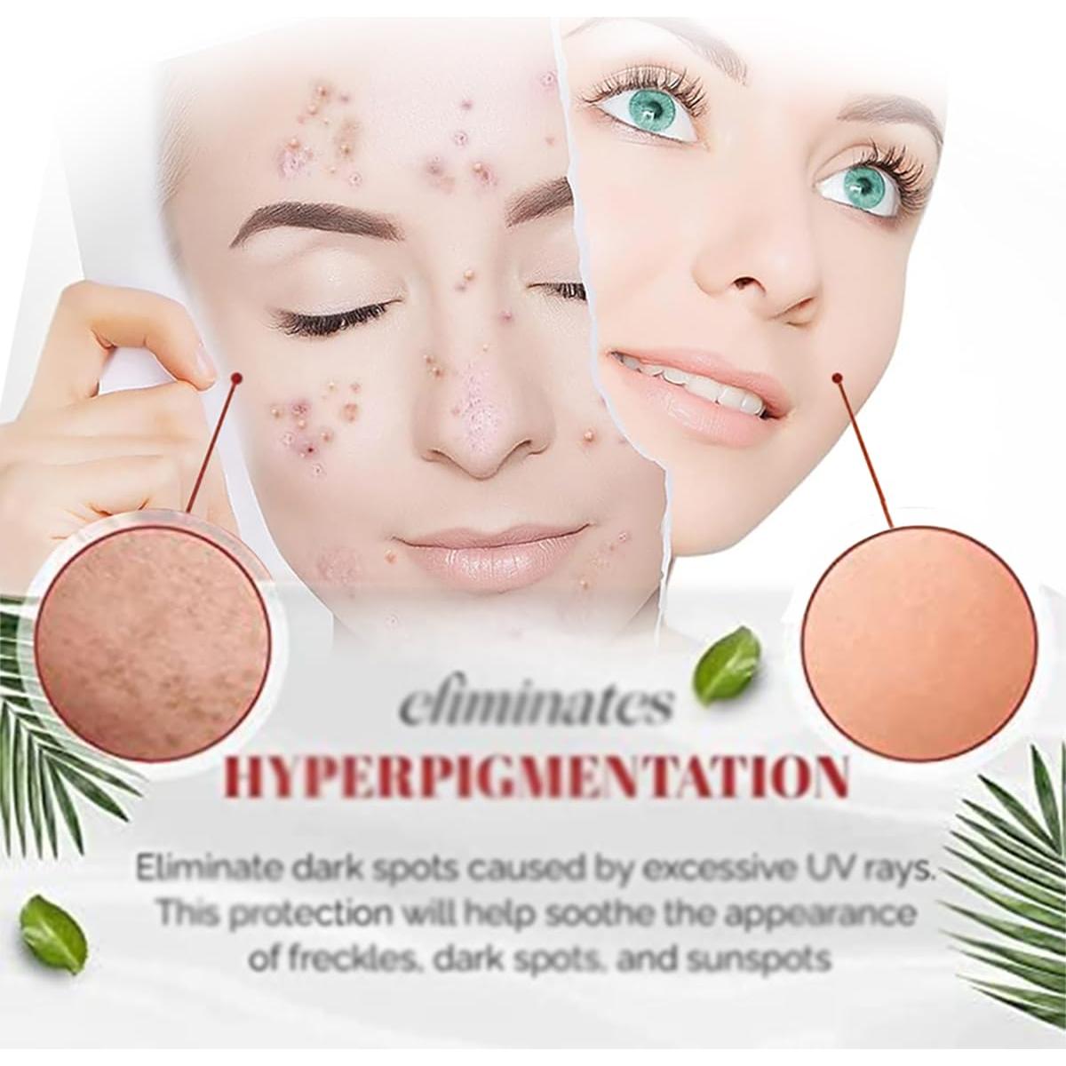 Crema de Niacinamida Natural 20g para Manchas Oscuras y Melasma