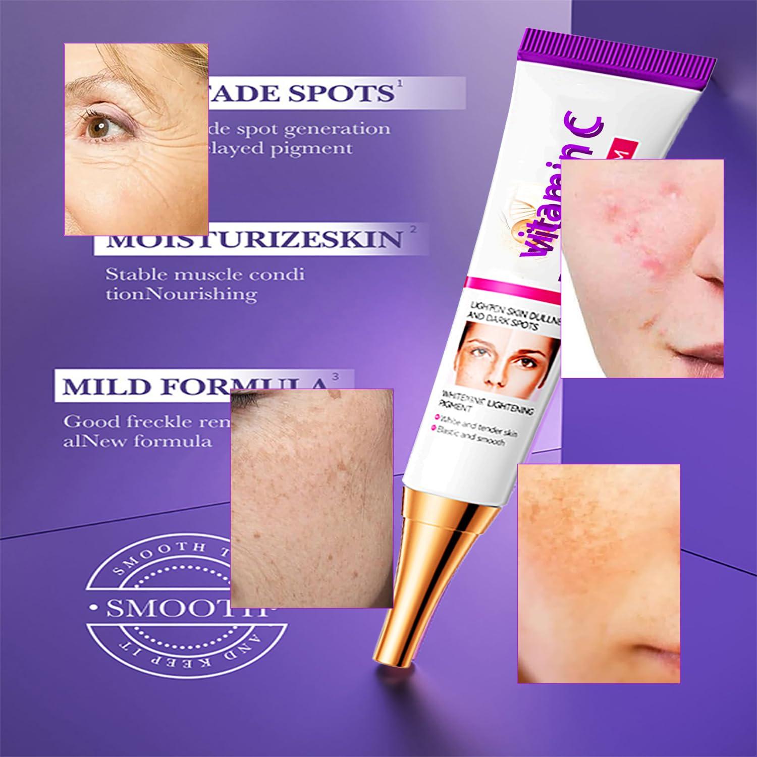 Crema de Niacinamida Natural 20g para Manchas Oscuras y Melasma