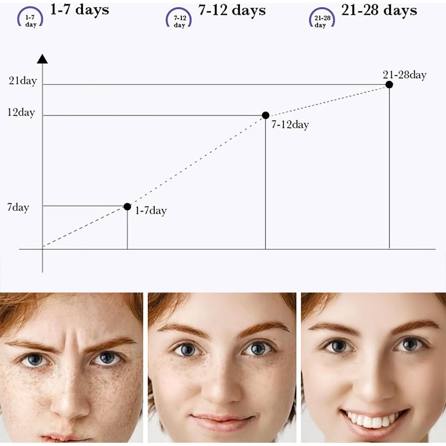 Crema de Niacinamida Natural 20g para Manchas Oscuras y Melasma