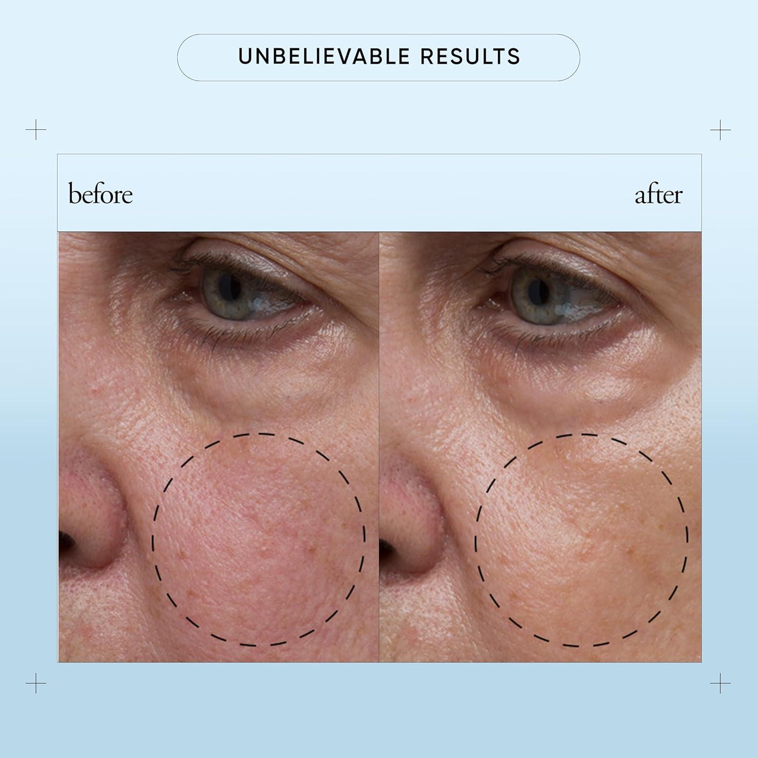 Suero Facial Philosophy Esperanza 29.57 ml - Ácido Hialurónico