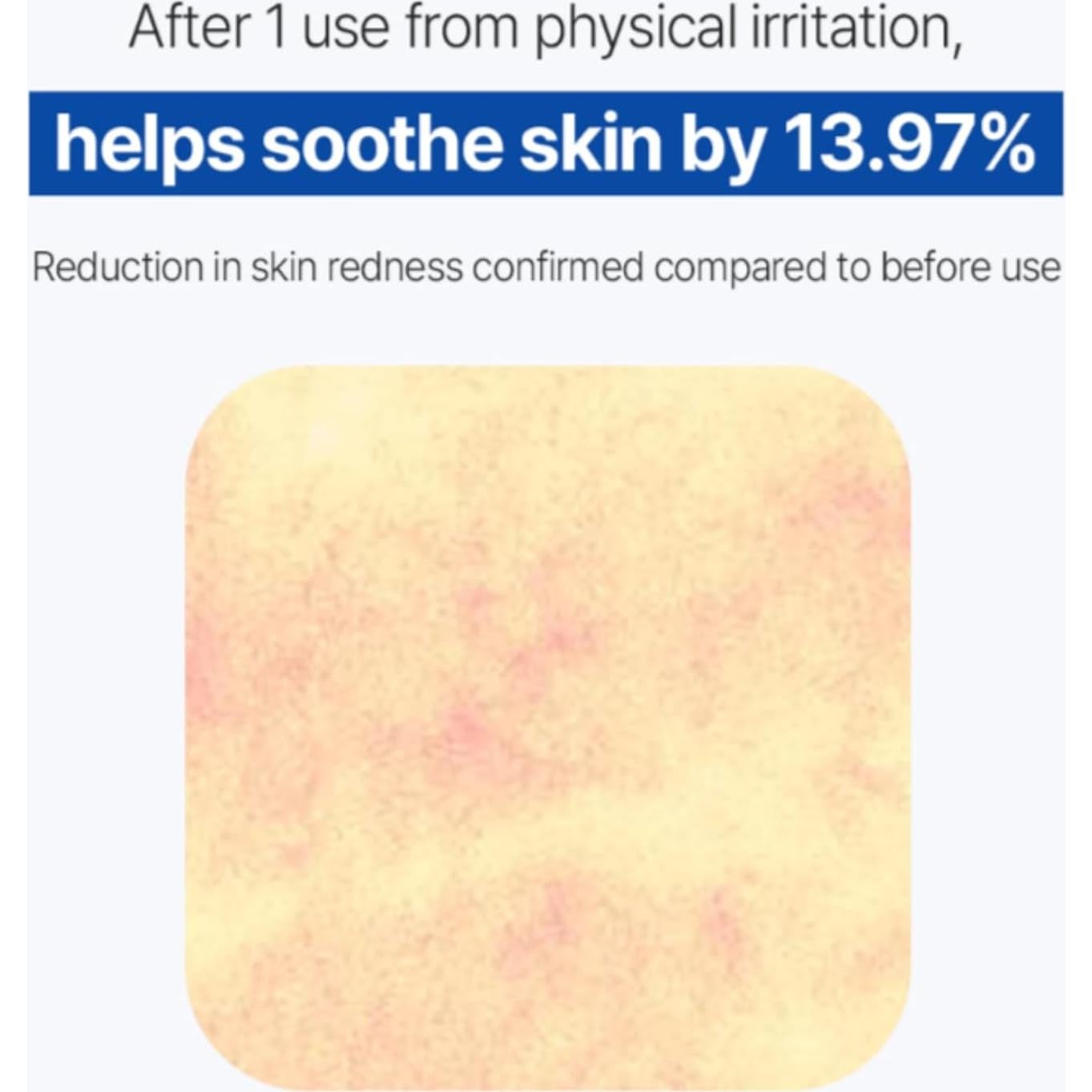 Suero de Alivio de Jengibre BONAJOUR para Piel Sensible 10ml