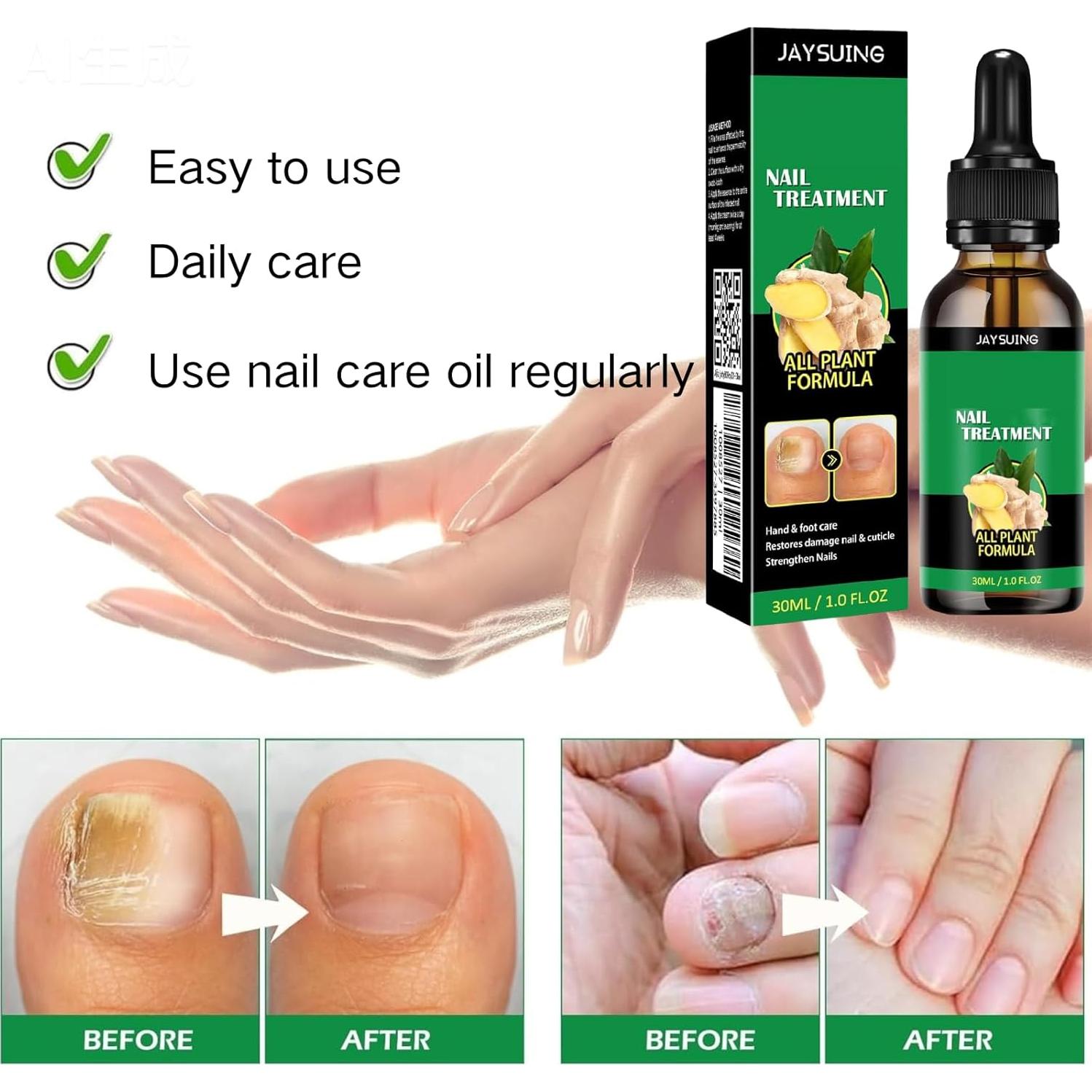 Suero de Uñas de Jengibre Jingchangdian 2 Pcs - Cuidado Cutículas