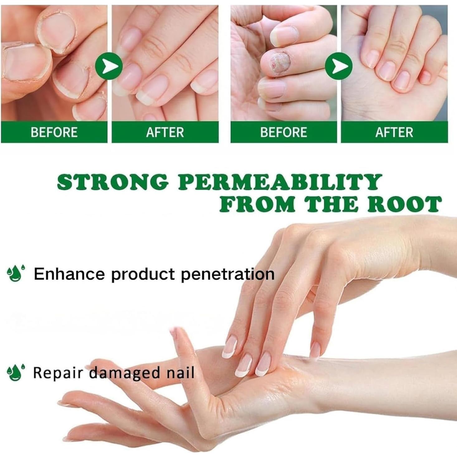 Suero de Uñas de Jengibre Jingchangdian 2 Pcs - Cuidado Cutículas