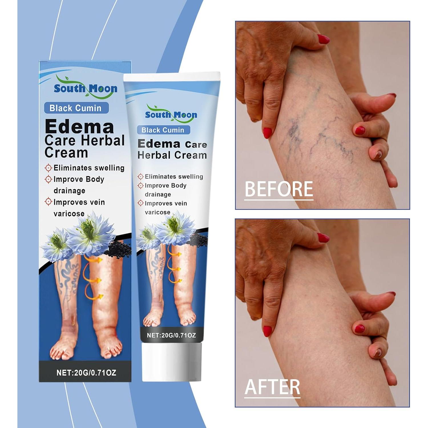 Crema Herbal South Moon para Cuidado de Edema 20g