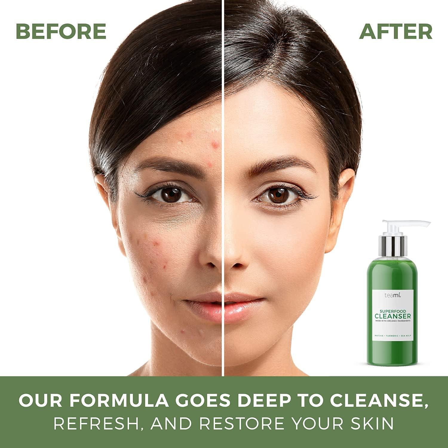 Limpiador Facial Teami 100ml con Ácido Salicílico y Aloe