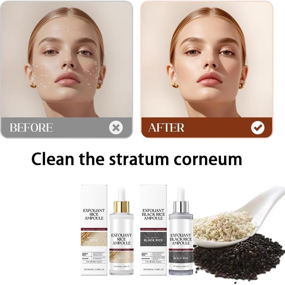 Conjunto de Ampollas Exfoliantes OVQ - Hidratación y Minimización de Poros