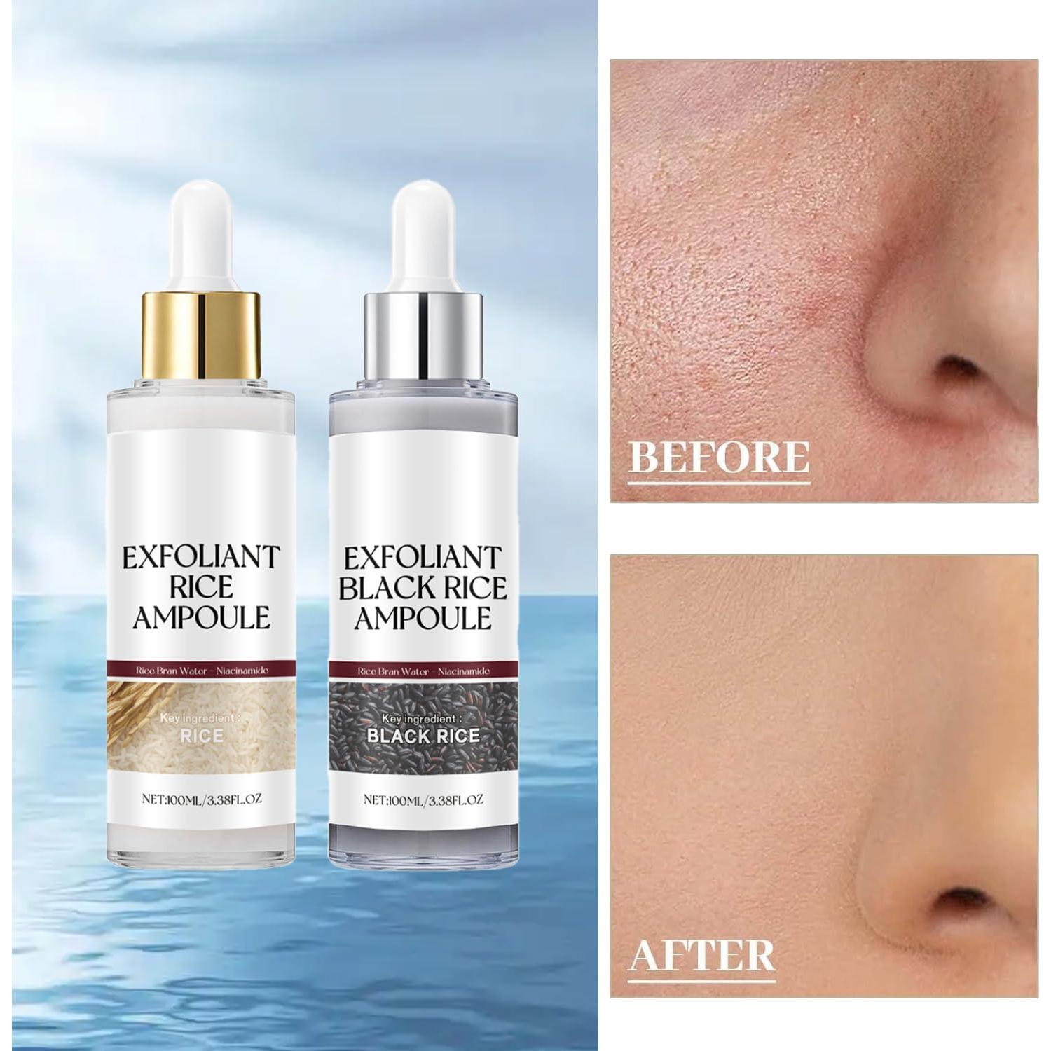 Exfoliante Suave de Arroz Negro y Blanco Krajiyya 2 Piezas