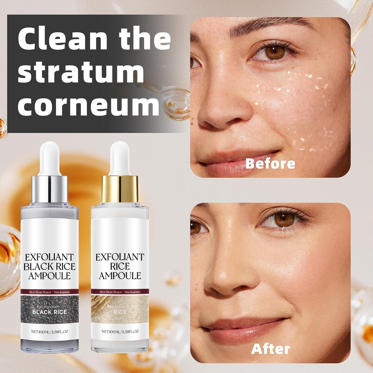 Conjunto de Ampollas Exfoliantes de Arroz Negro y Blanco - TooAemiS