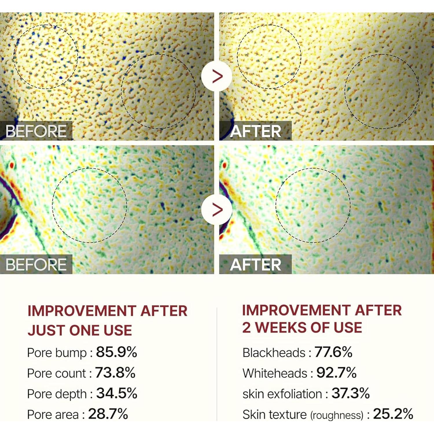 Ampolla Exfoliante de Arroz Negro y Blanco - 80ml - 2 PCS