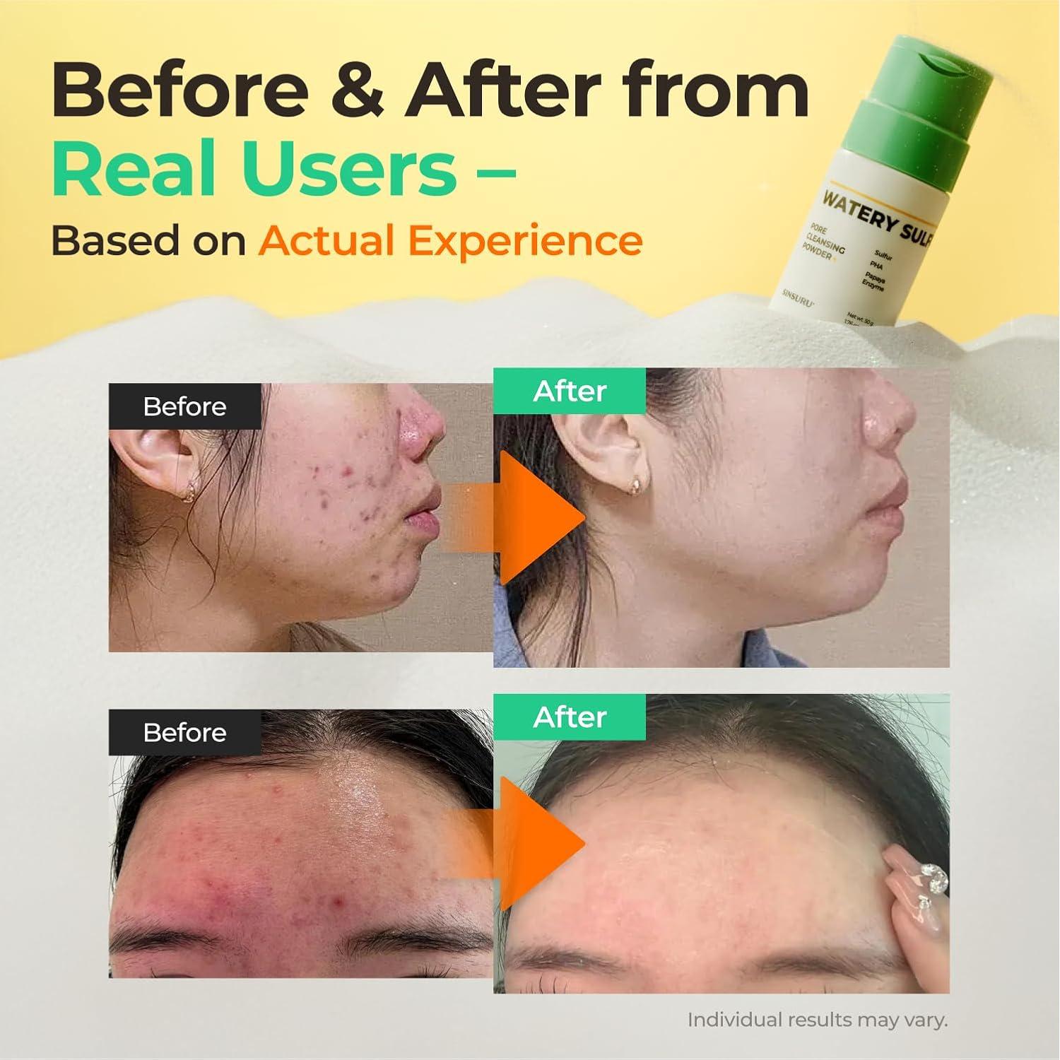 Limpiador Facial en Polvo Wonderwall 50g - Piel Sensible, Sin Fragancia