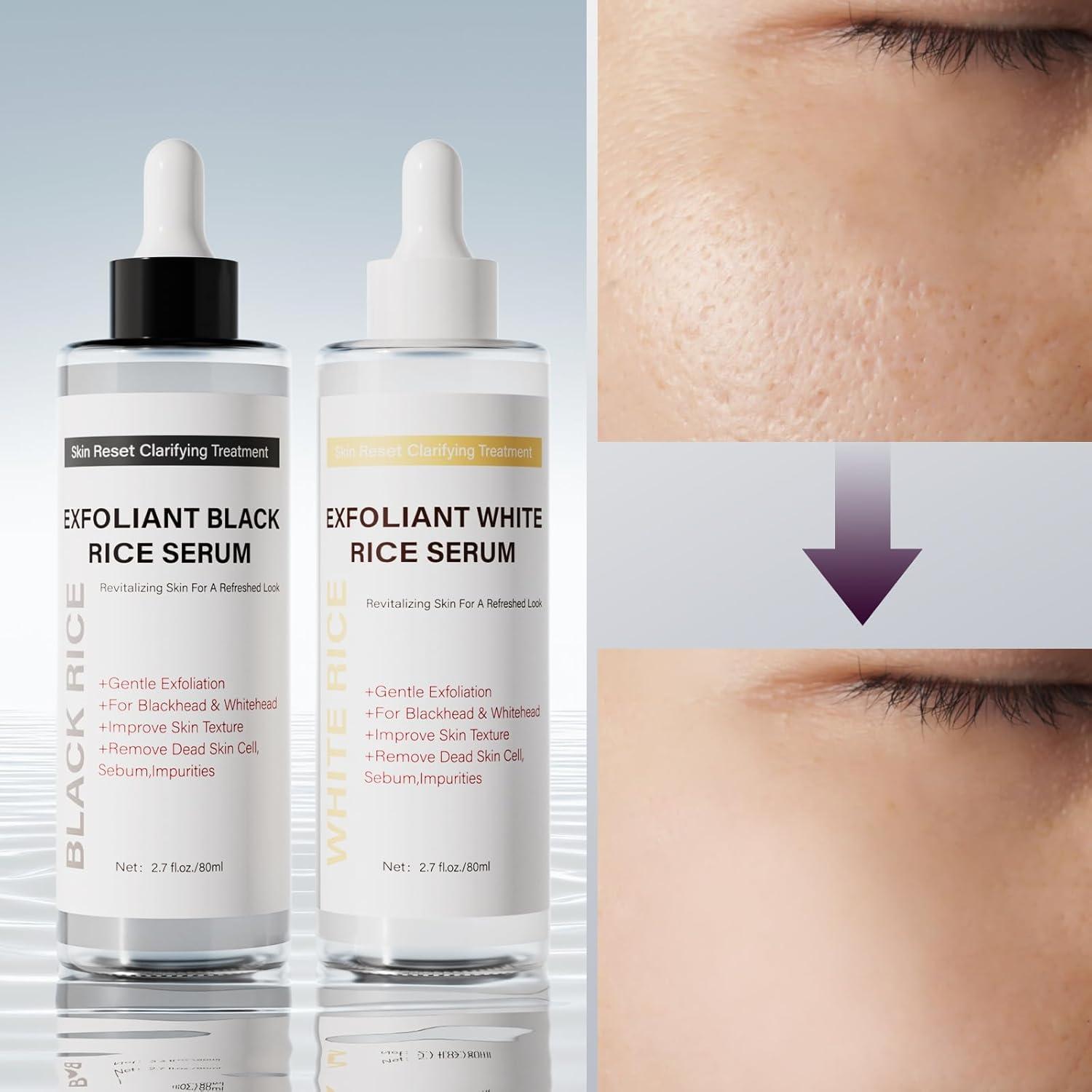 Exfoliante de Arroz Negro PIVETOS 421g Limpieza Profunda