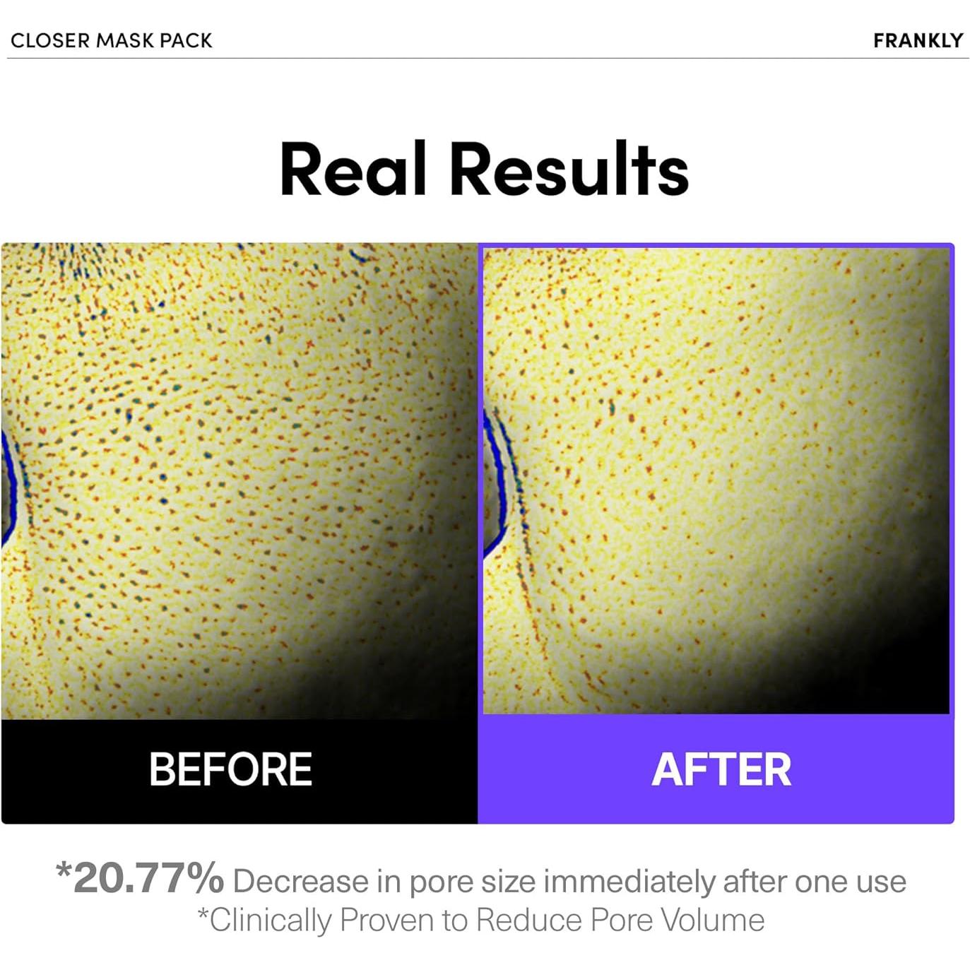 Máscara Facial Frankly Closer - Minimiza Poros, 21.9 ml