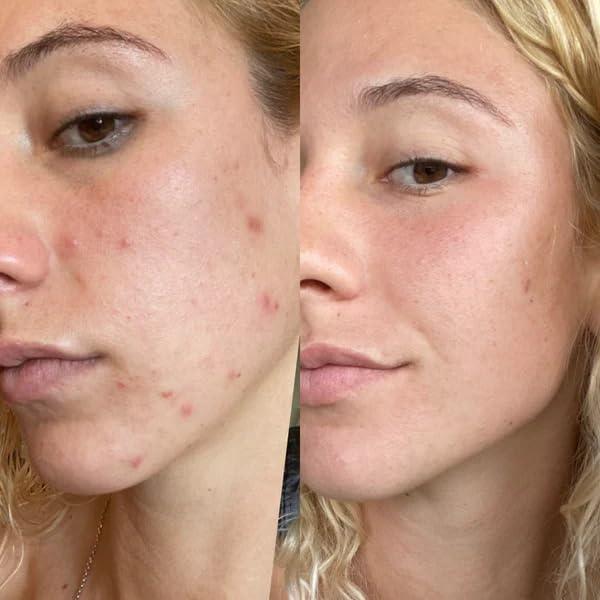 Suero de Retinol 2.5% Gin Amber Beauty - Antienvejecimiento 30 ml