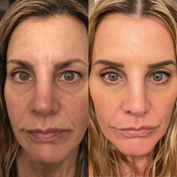 Suero de Retinol 2.5% Gin Amber Beauty - Antienvejecimiento 30 ml