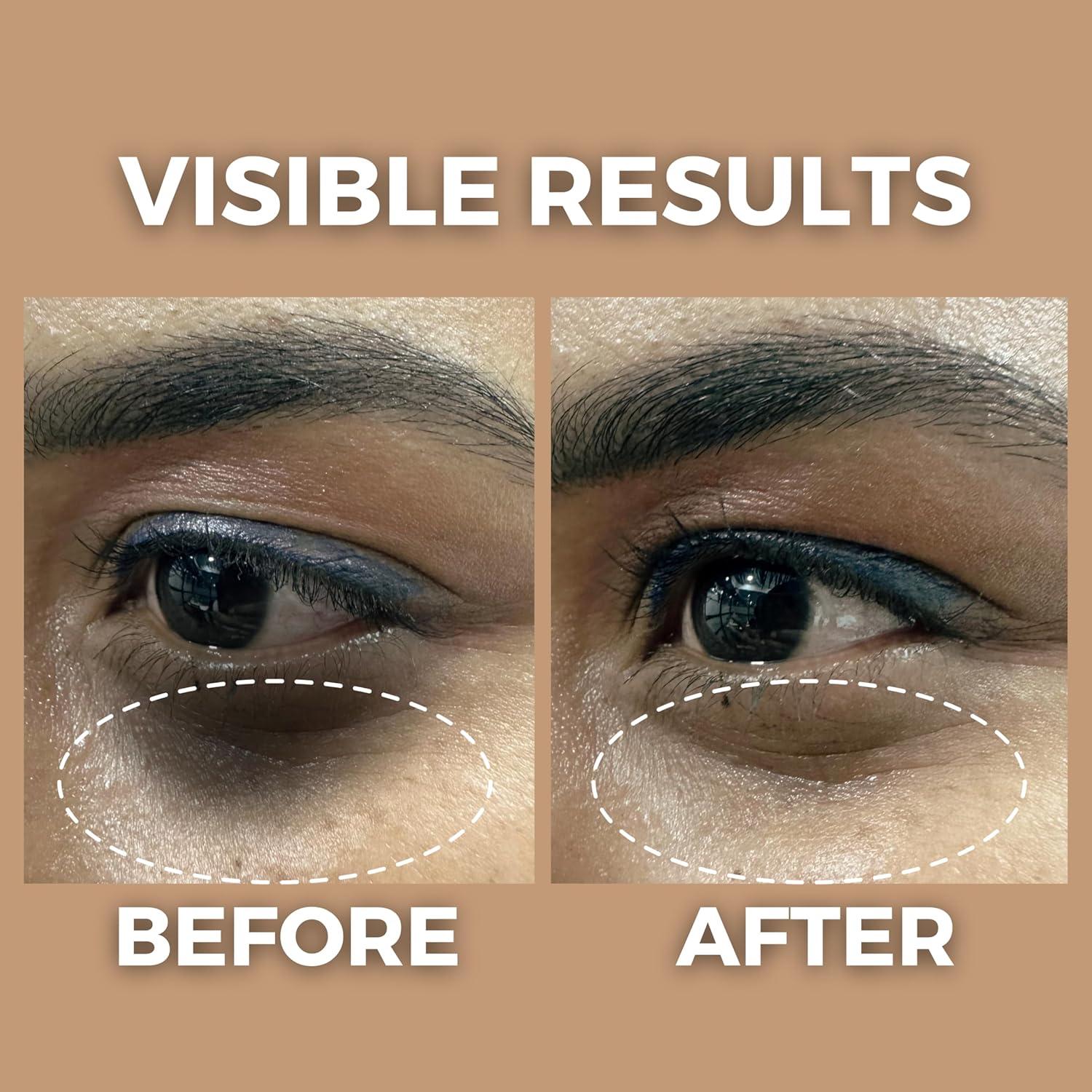 Aceite Iluminador Contorno Ojos The Tribe Concepts 8ml