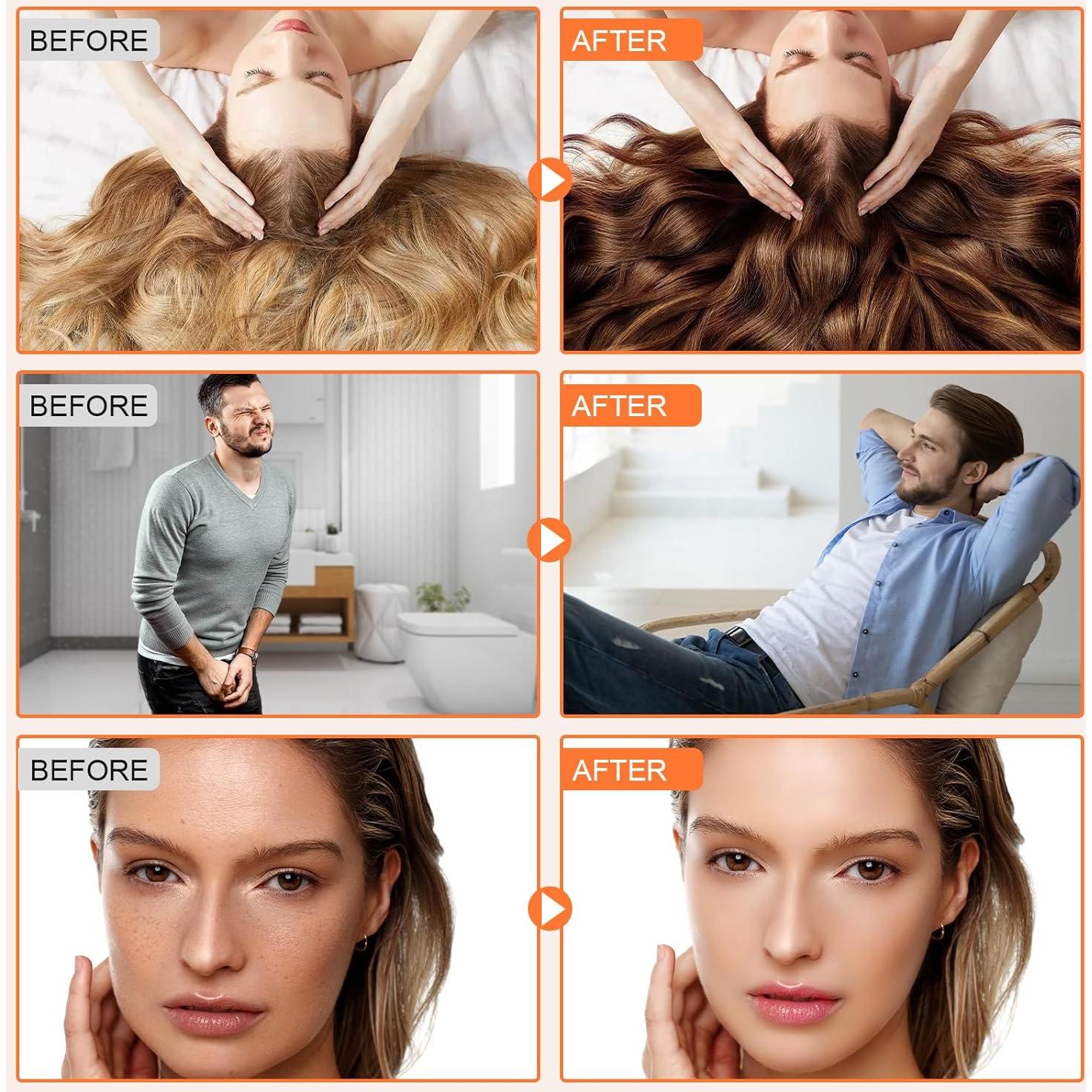 Aceite de Semilla de Calabaza 1000mg con Saw Palmetto 300 Softgels