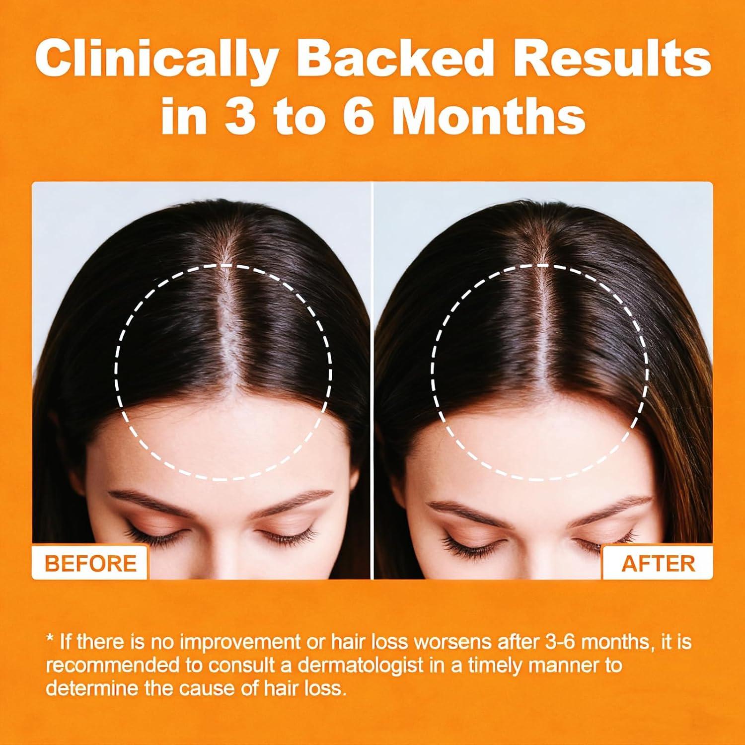 Gomitas de Aceite de Semilla de Calabaza JOVITHEA 60 Unidades