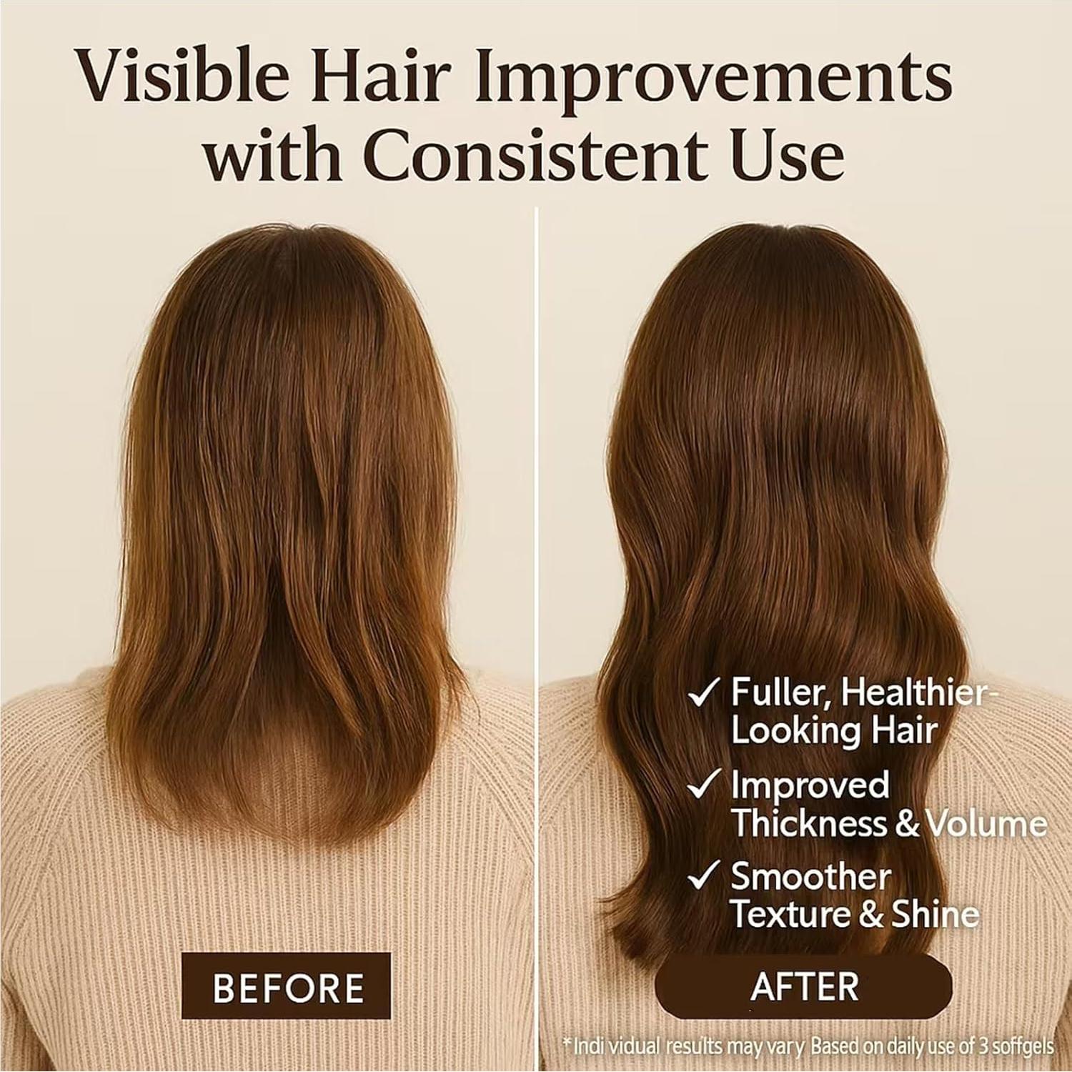 Aceite de Semilla de Calabaza Ovela 3000mg con Saw Palmetto - 300 Softgels