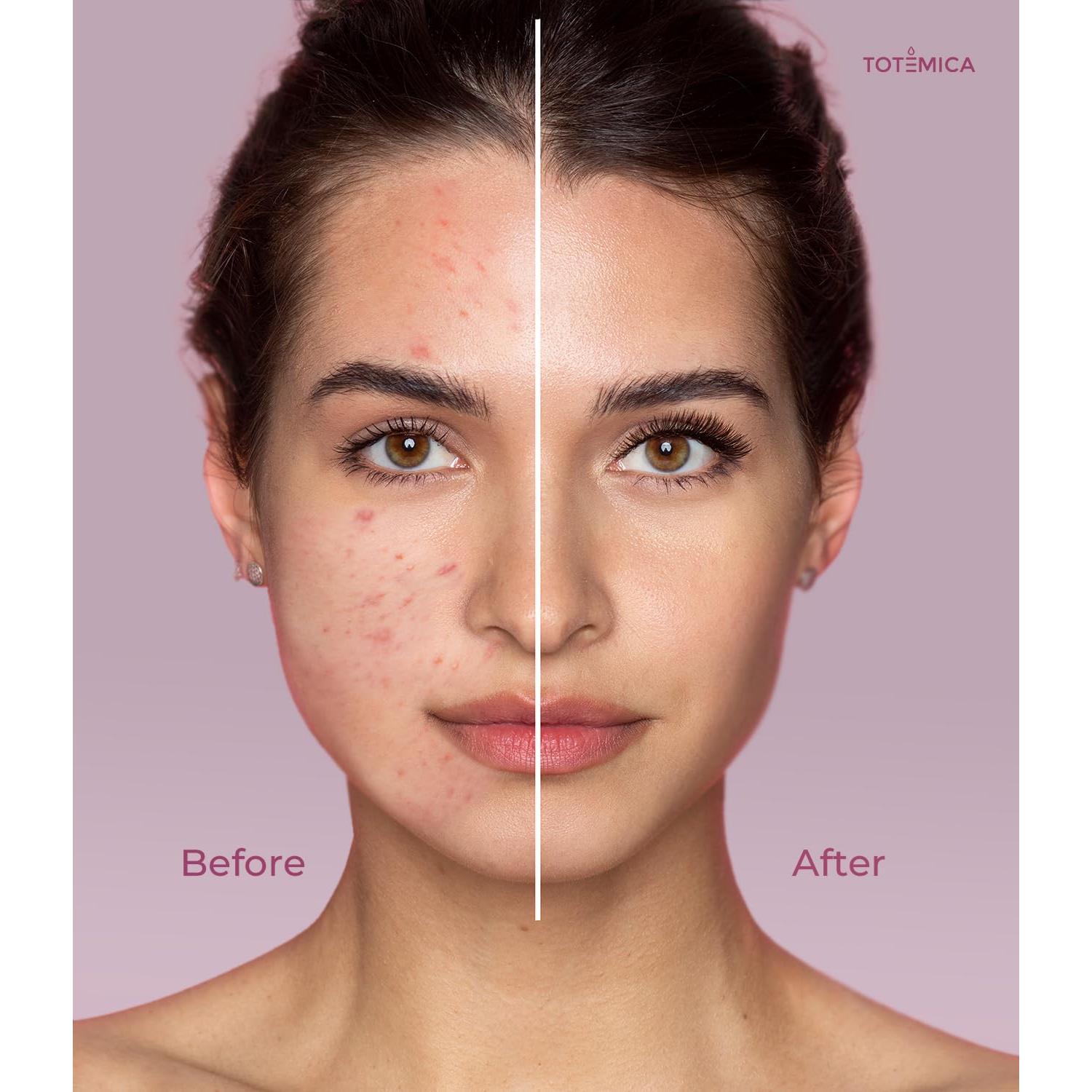 Desmaquillante Aceite Limpiador Totemica 150ml Piel Sensible