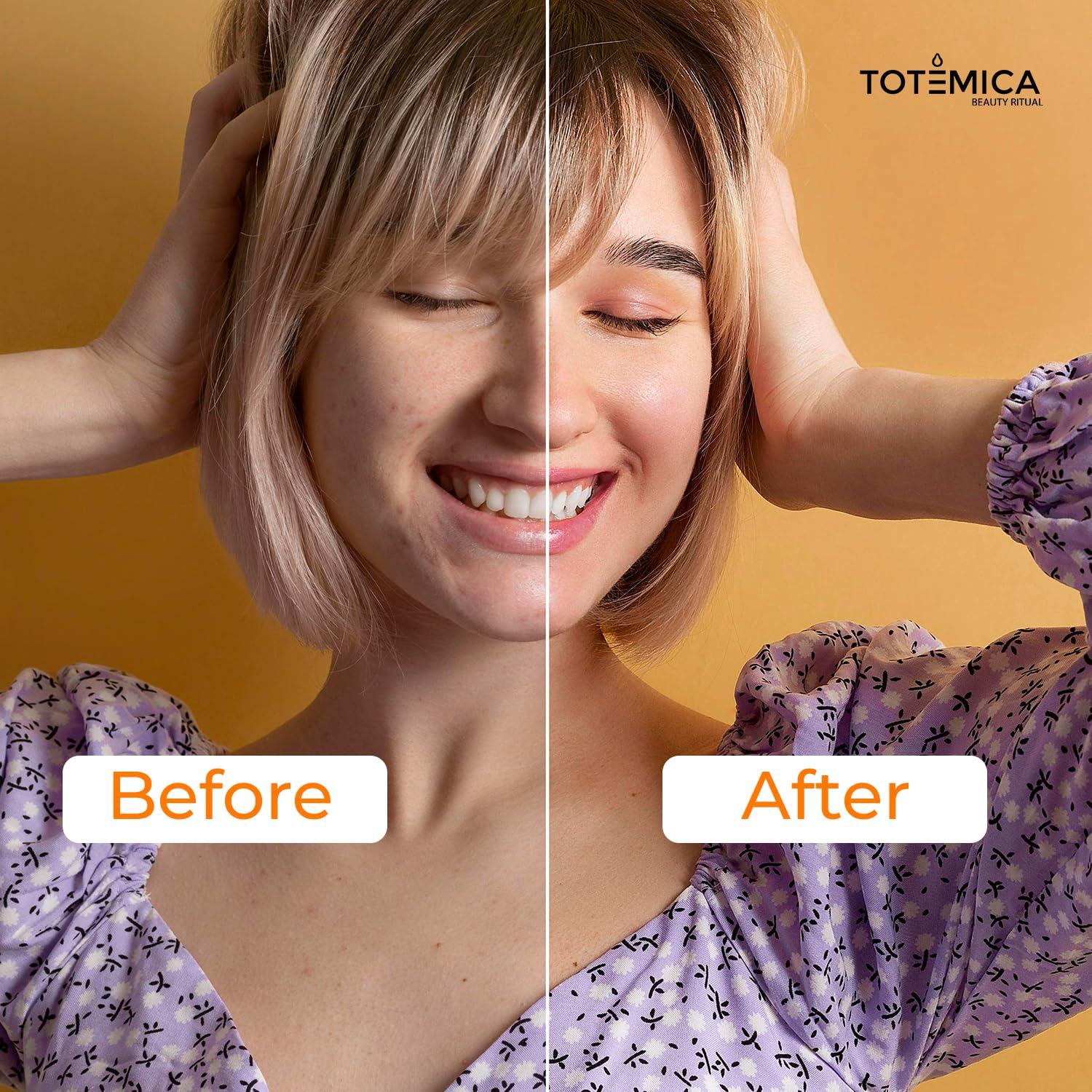 Suero Facial Antioxidante TOTEMICA Vitamina C 30 ml