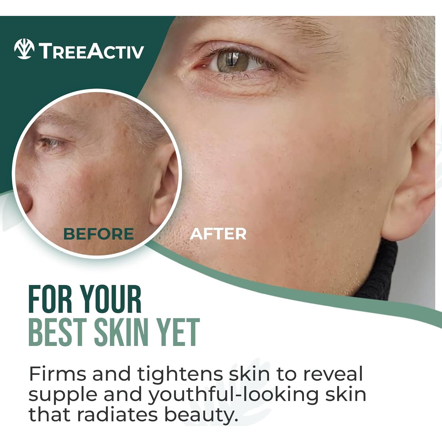 Crema de Retinol TreeActiv 60 ml - Hidratante Anti-Envejecimiento