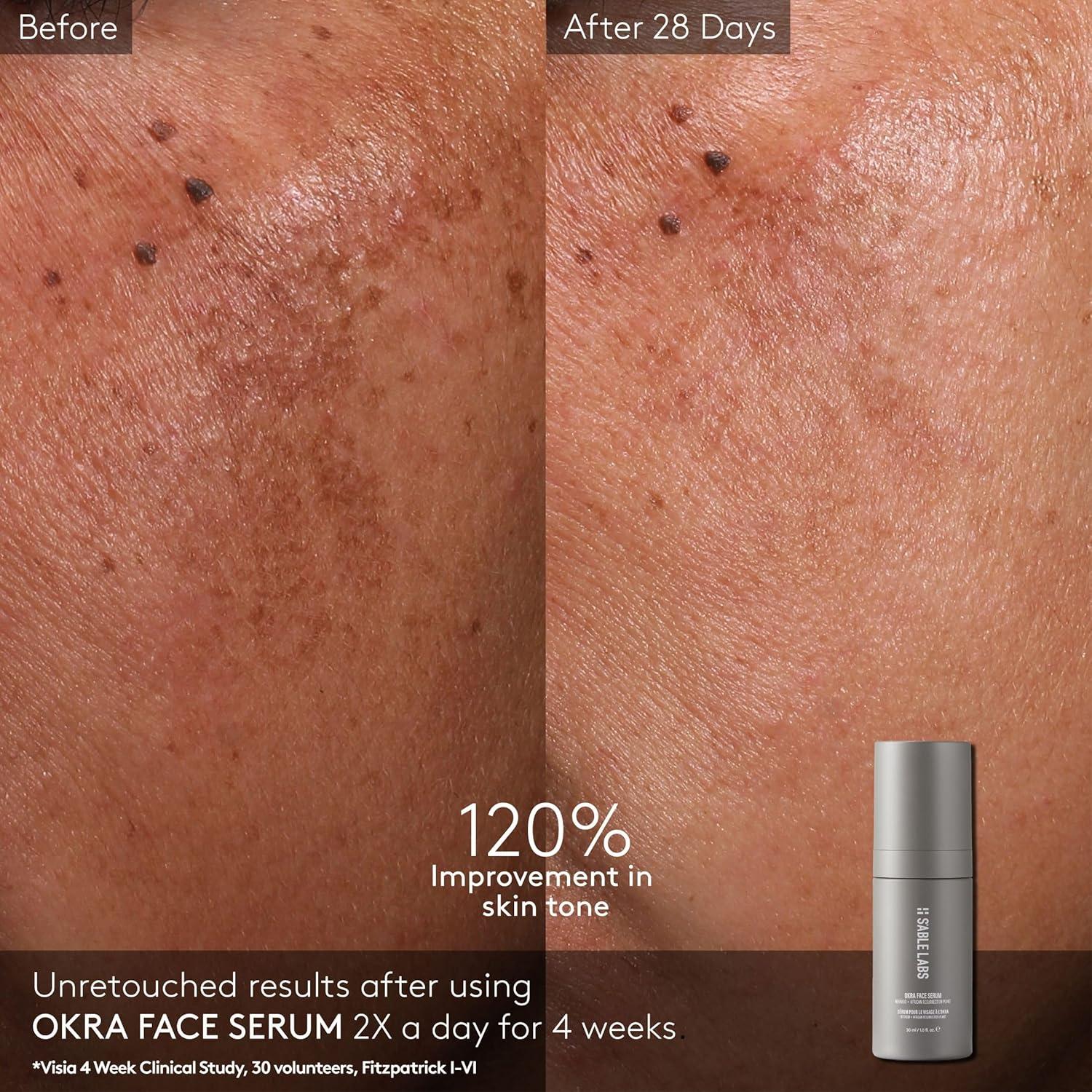 Suero Facial S'ABLE Labs 30 mL | Aumenta Elasticidad y Colágeno