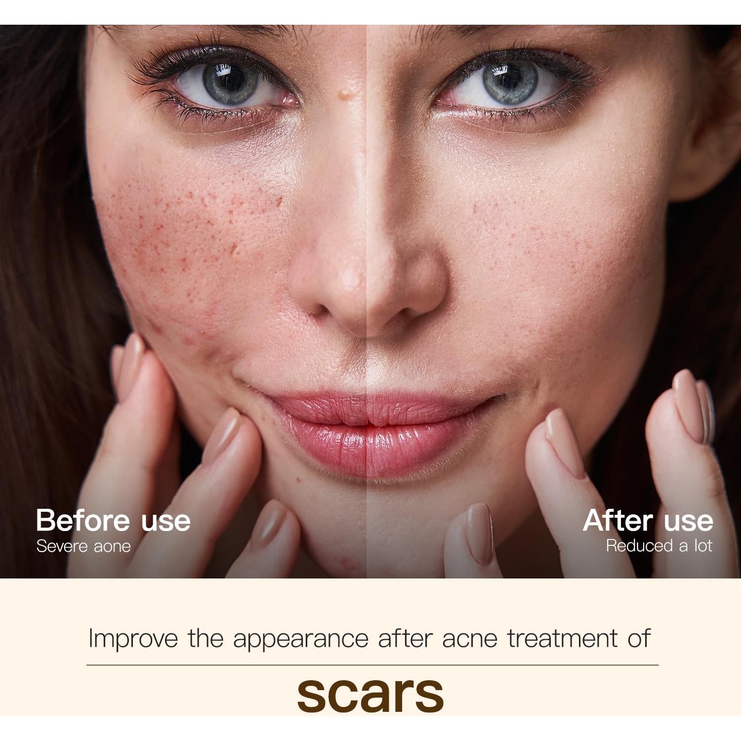 Aceite de Rosa Mosqueta Orgánico UWPU 30ML - Hidratante Facial