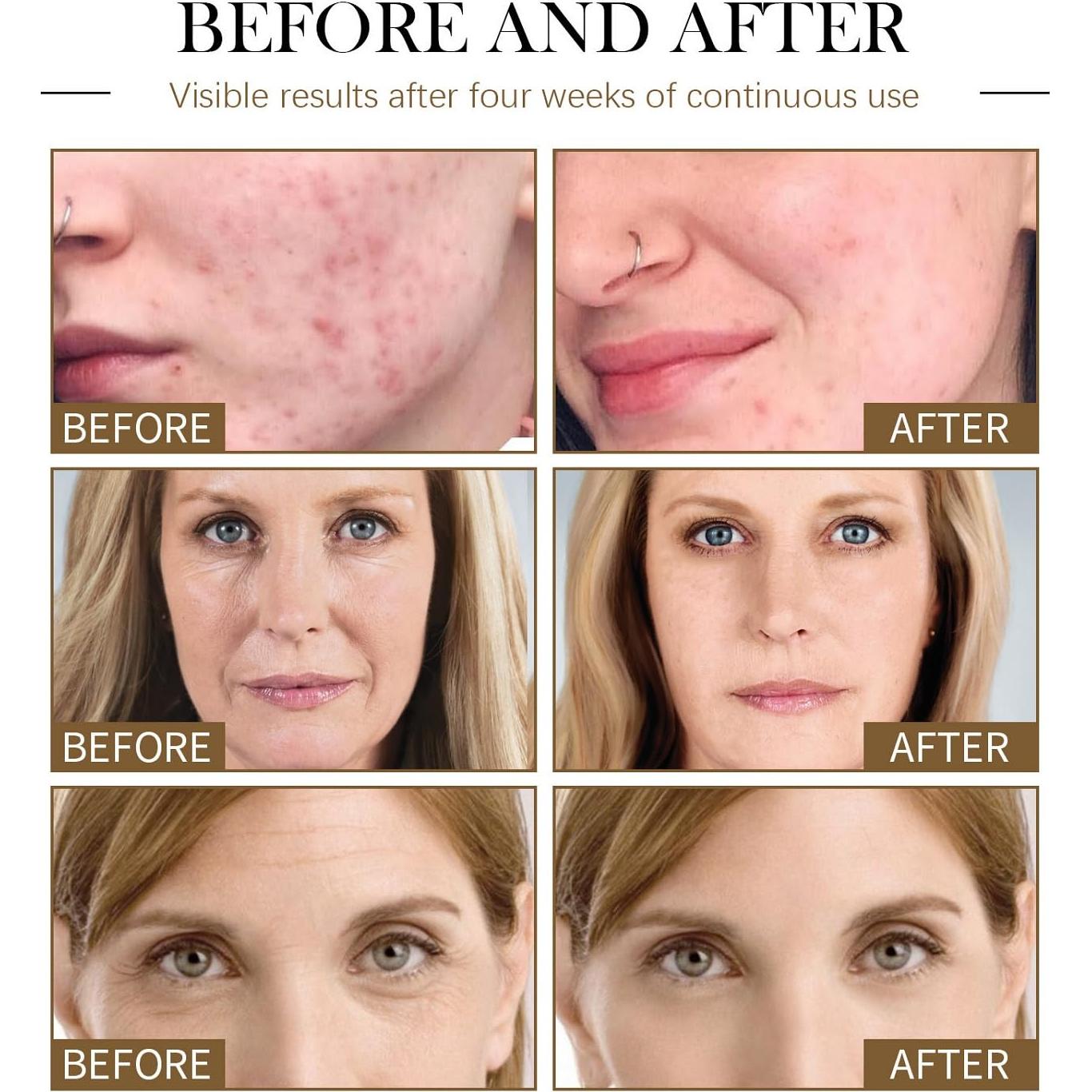 Suero Facial Orgánico 3Pcs - Aceite de Rosa Mosqueta, Ricino y Semilla Negra 30ml