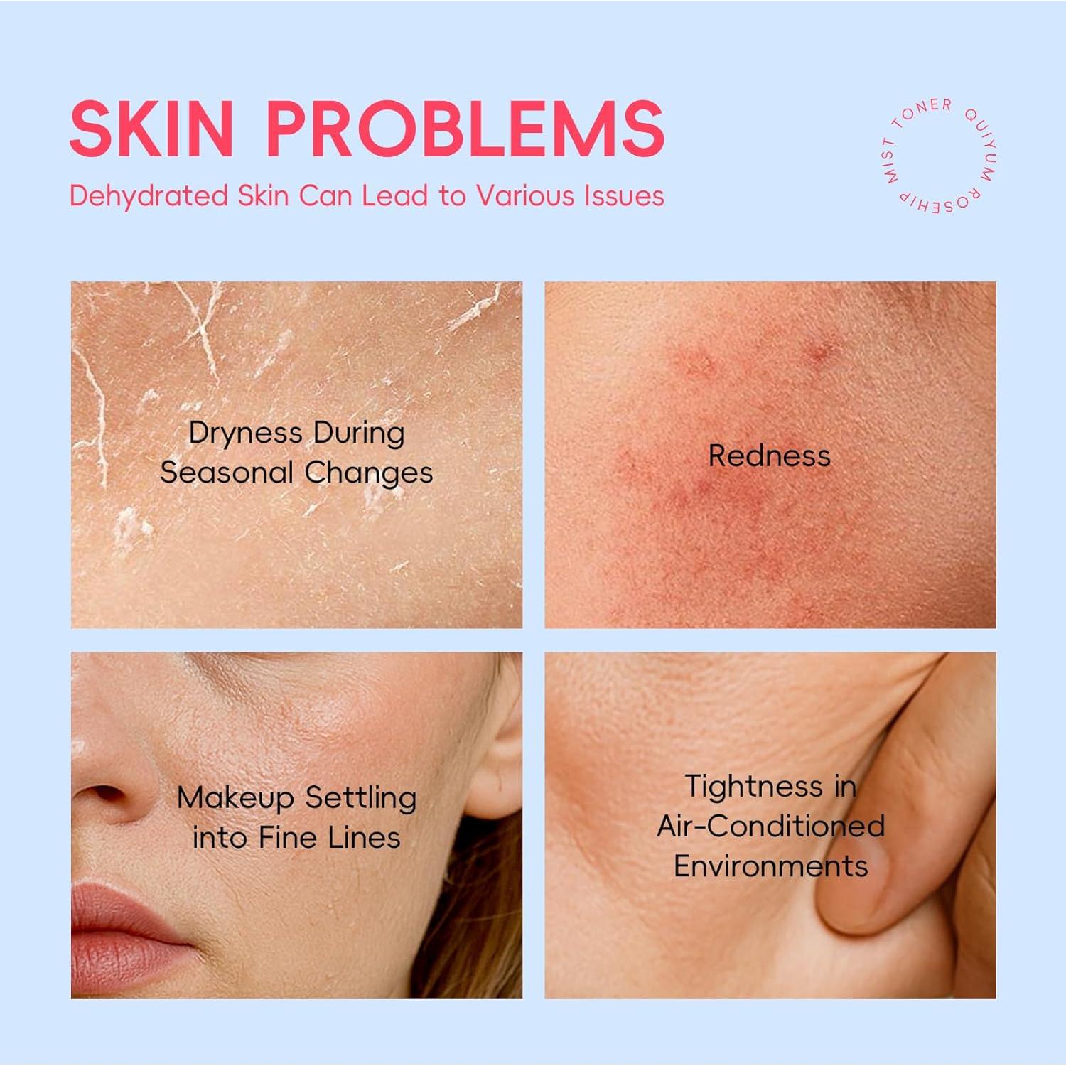 Conjunto de Cuidado de Piel QUIYUM 5 Piezas - Frutas y Rosa Mosqueta