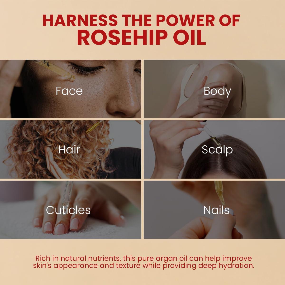 Aceite de Rosa Mosqueta Orgánico Viva Doria 30 ml Puro y Natural