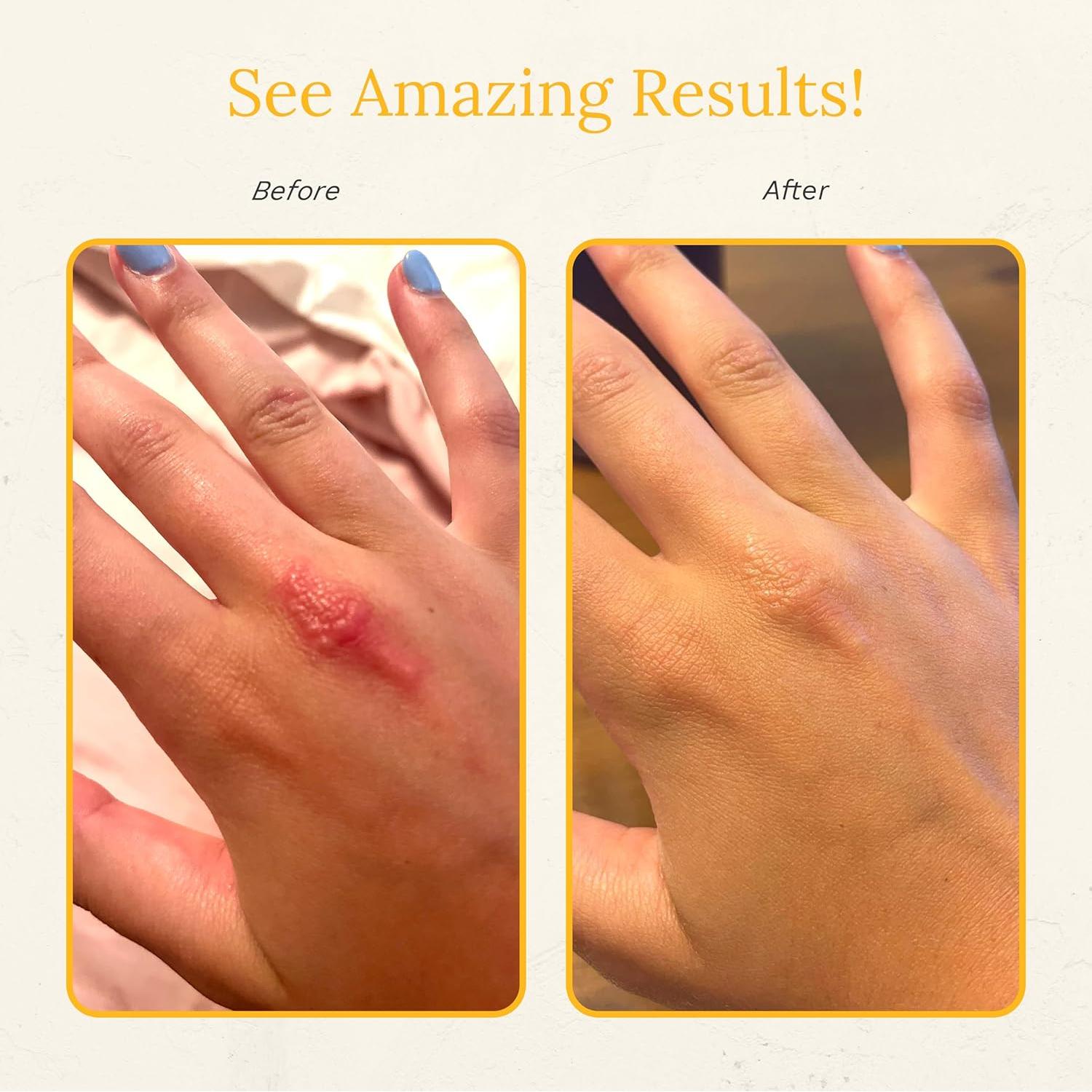 Crema Hidratante Rejuvaskin con Aloe Vera 100 ml para Piel Seca