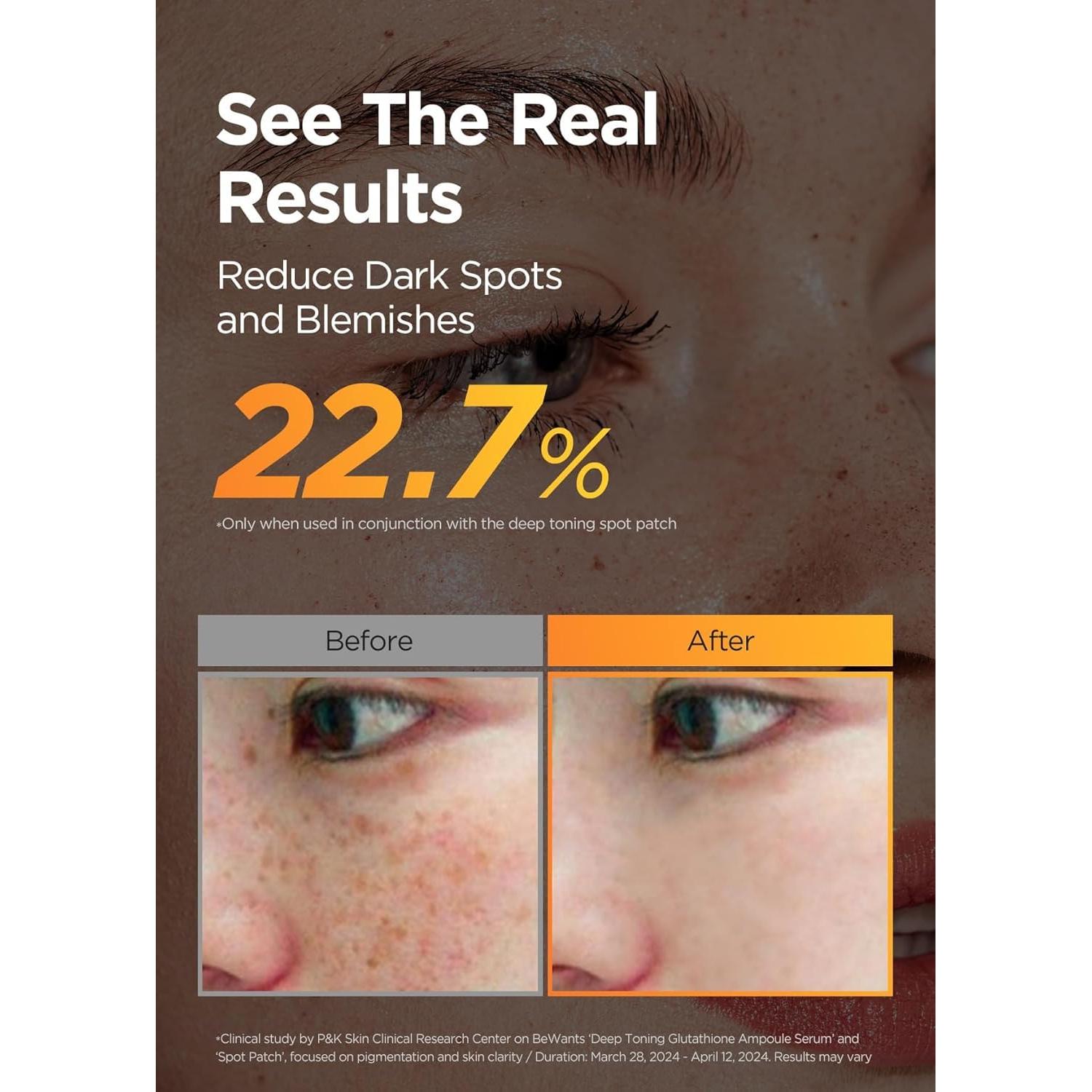 Suero Ampoule de Glutatión Bewants 30 ml + 10 ml Cuidado Piel