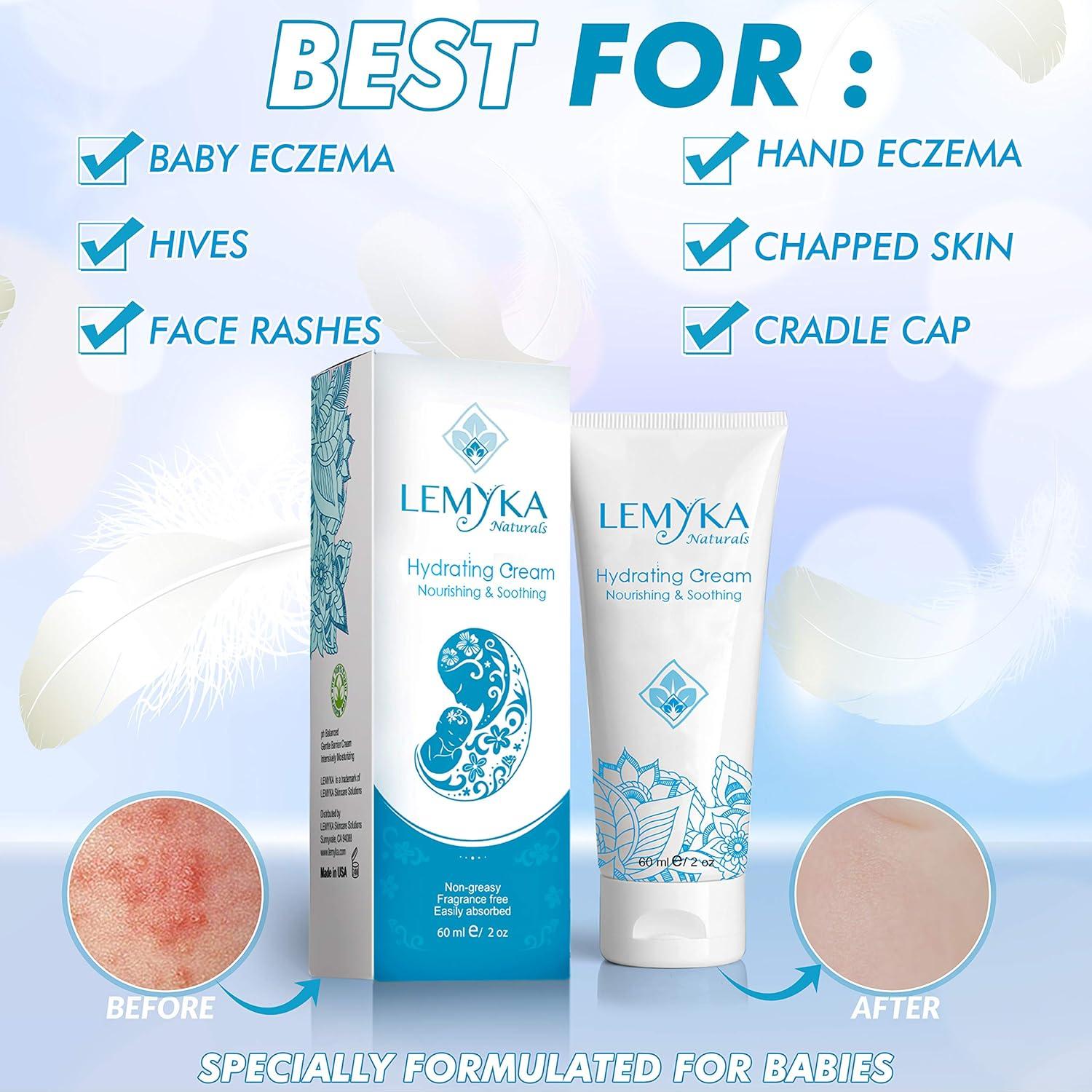 Crema Orgánica para Bebés LEMYKA 56g Eczema y Piel Seca
