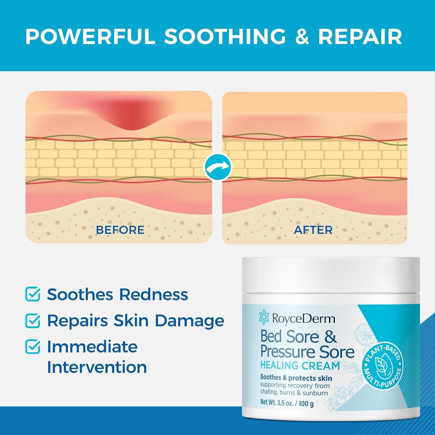 Crema para Úlceras por Presión Roycederm 99.22 g - Curación Rápida