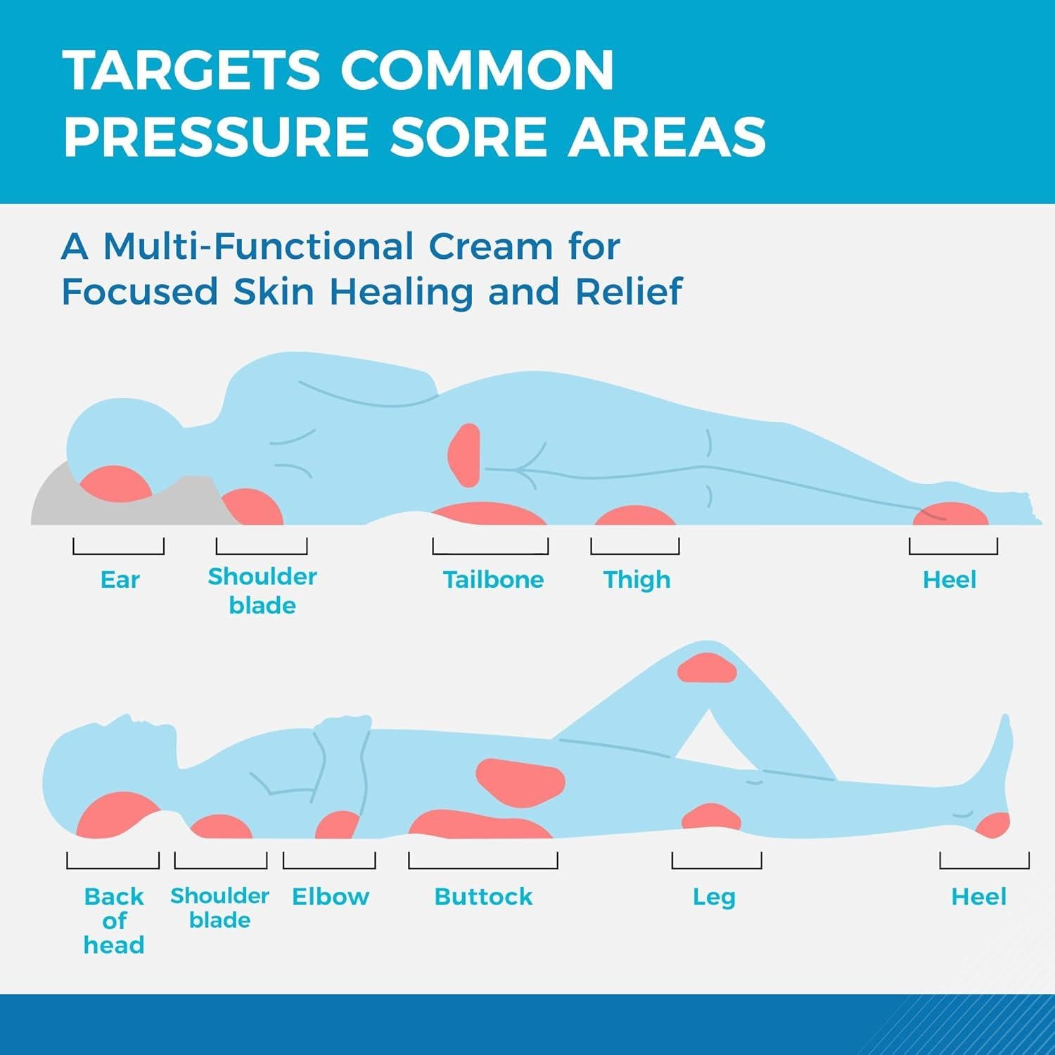 Crema para Úlceras por Presión Roycederm 99.22 g - Curación Rápida