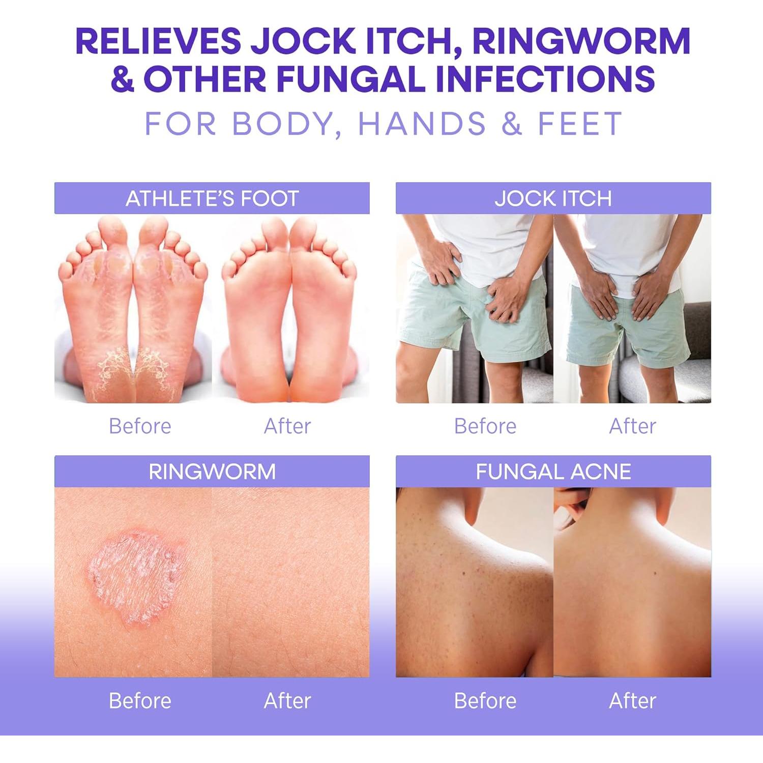 Jabón Antifúngico Hermon con Aceite de Árbol de Té 322g