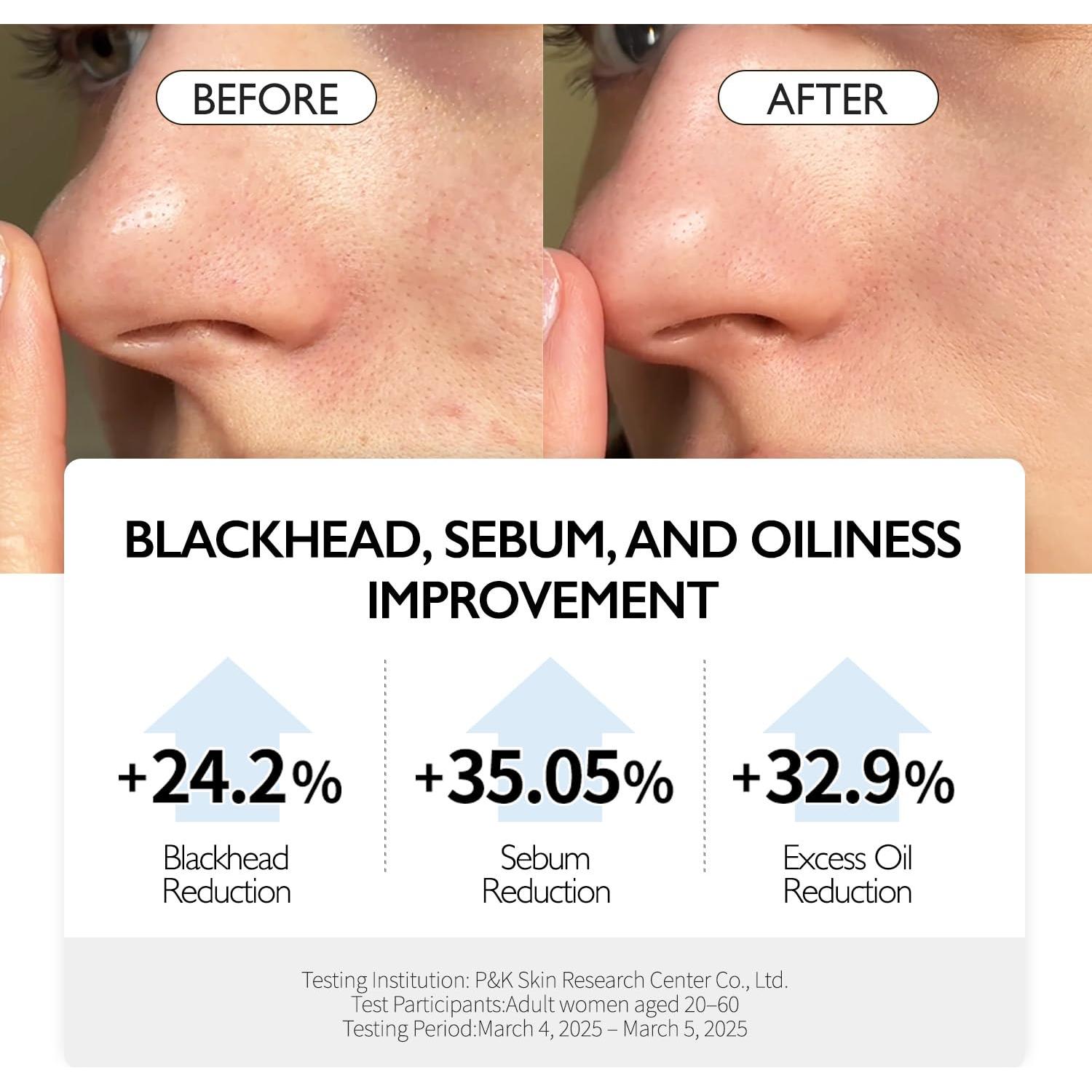 Aceite Limpiador Profundo VIDIVICI 300 ml - Control de Poros