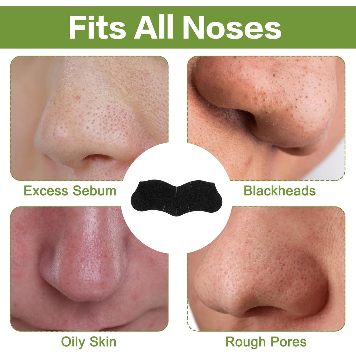 Tiras Eliminadoras de Puntos Negros YUXIANLB 120 Piezas Carbón Activado