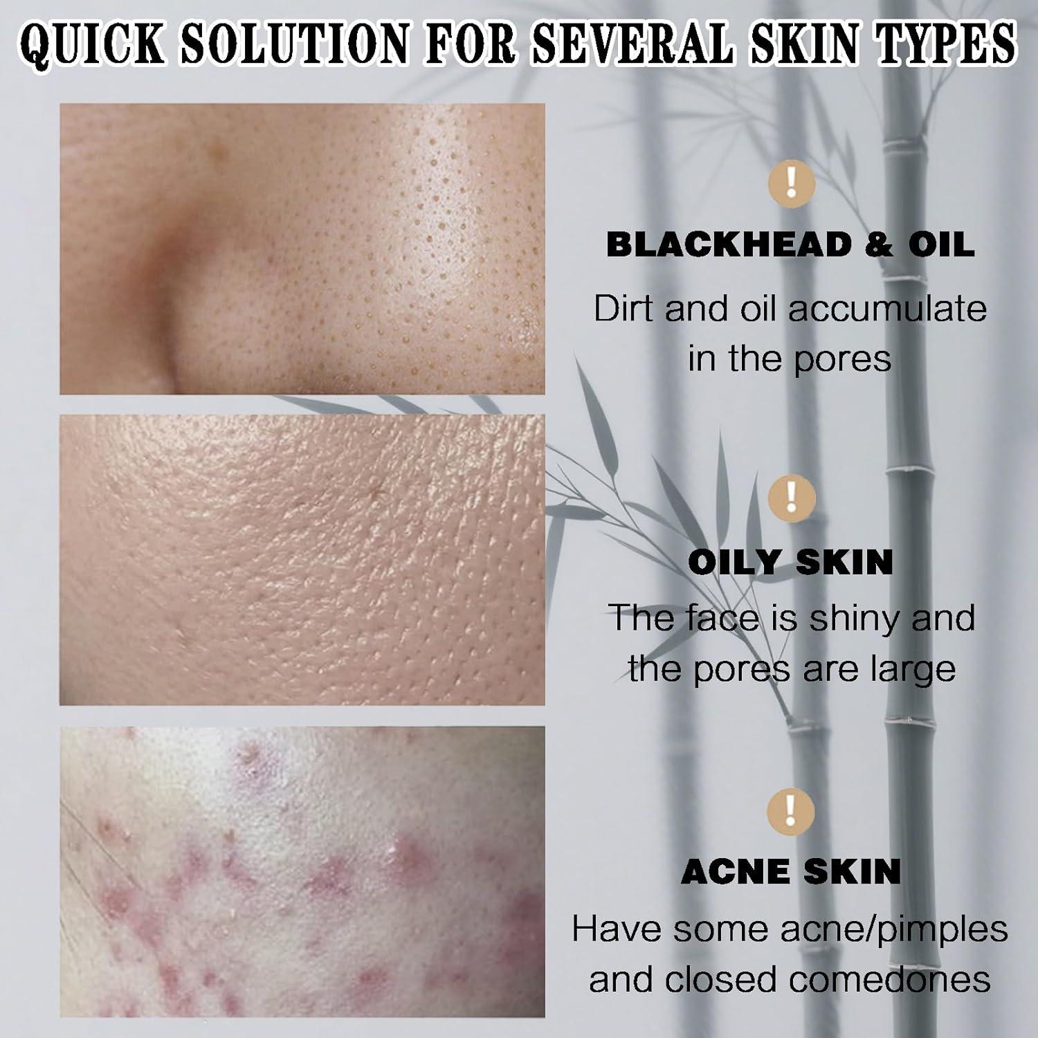 Máscara Exfoliante de Carbón de Bambú - Limpieza Profunda y Control de Aceite