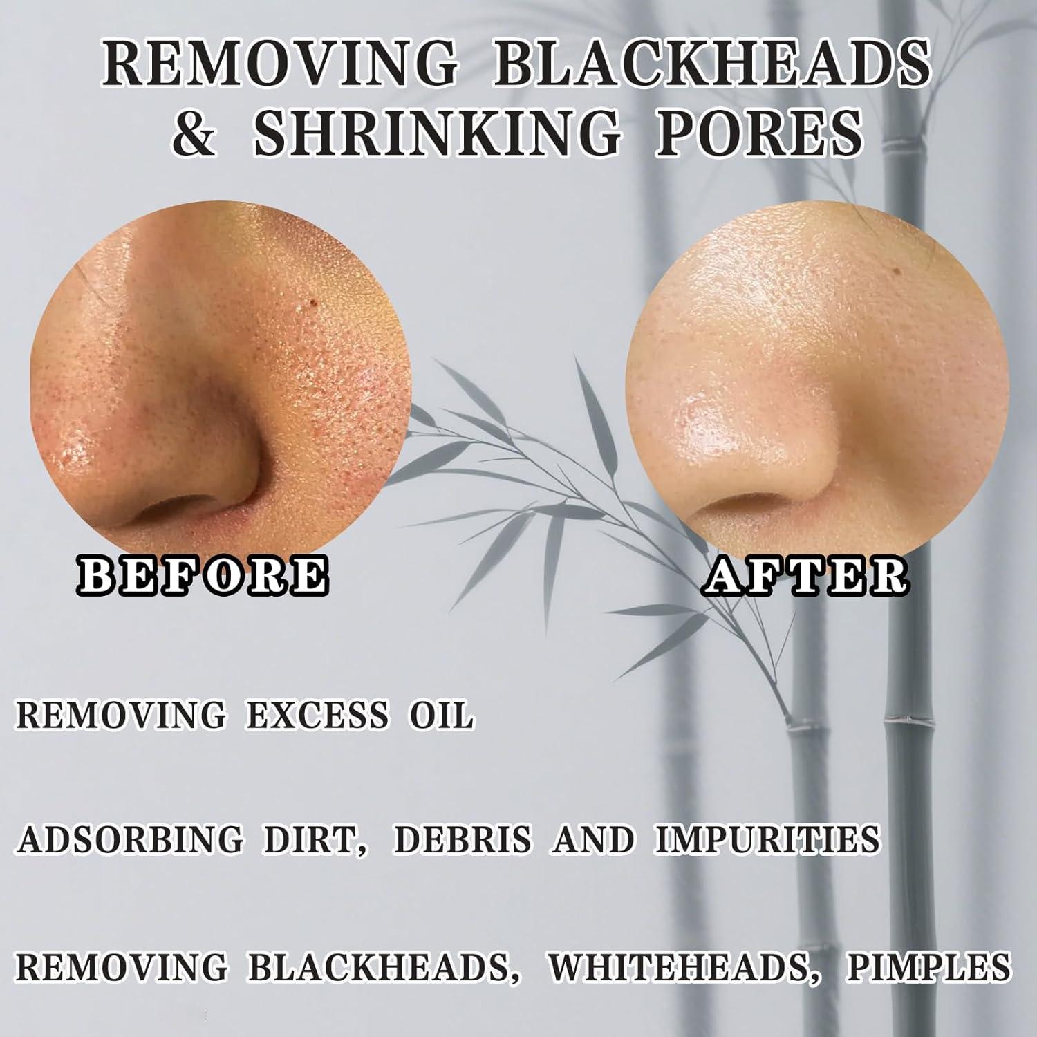 Máscara Exfoliante de Carbón de Bambú - Limpieza Profunda y Control de Aceite