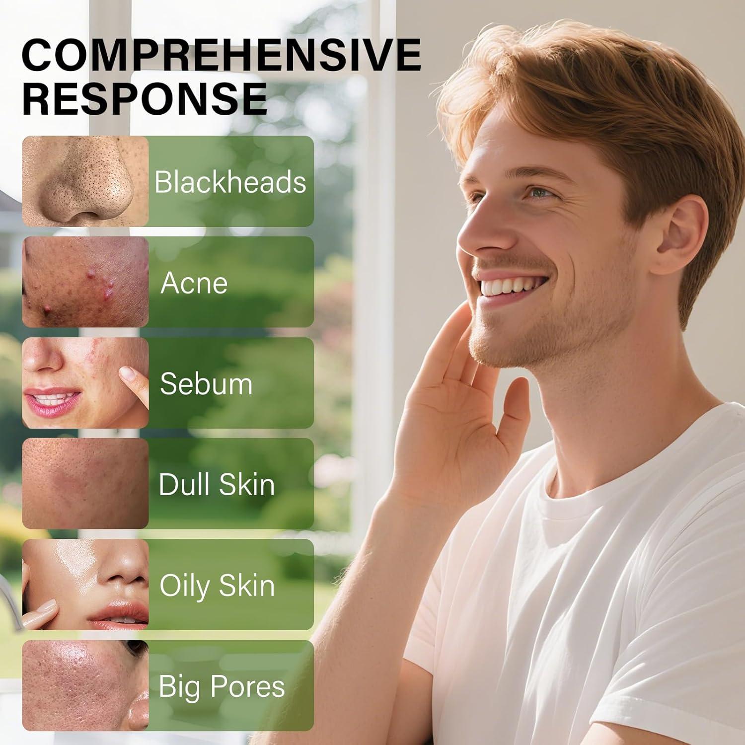 Mascarilla Peel Off Carbón Activado 120g - Limpieza Puntos Negros