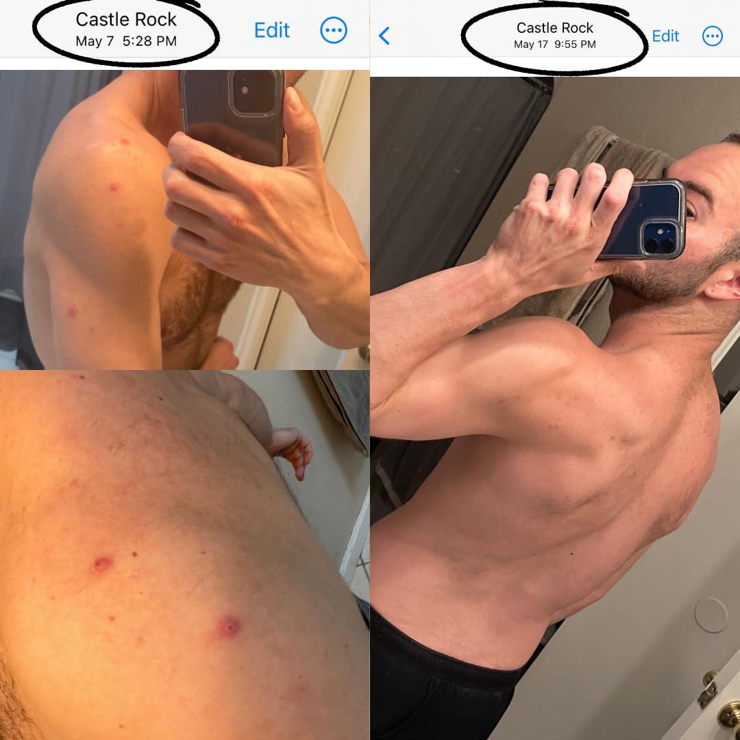 Jabón Corporal Natural Bacne Bar Vermont Soaps 113g Acné