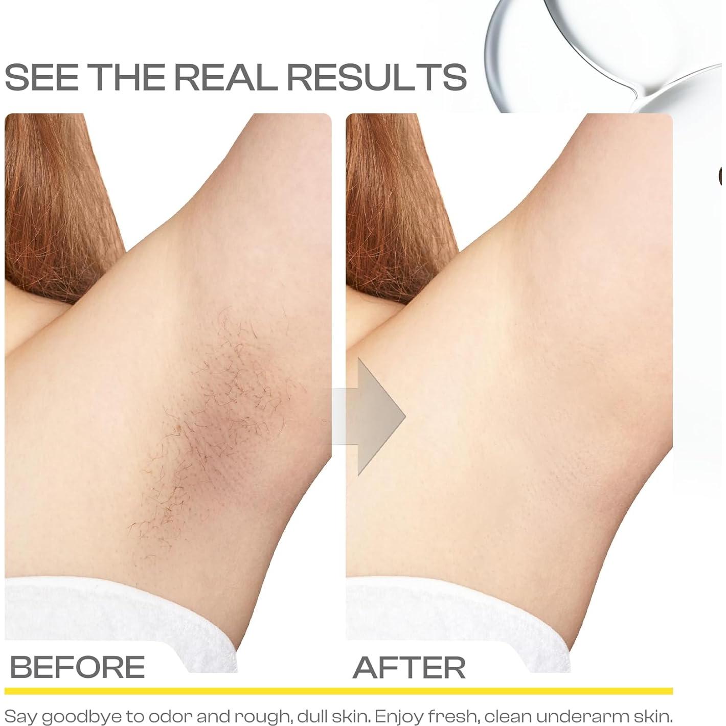 Exfoliante Detox Jtopyrt de Carbón de Coco para Axilas 290g