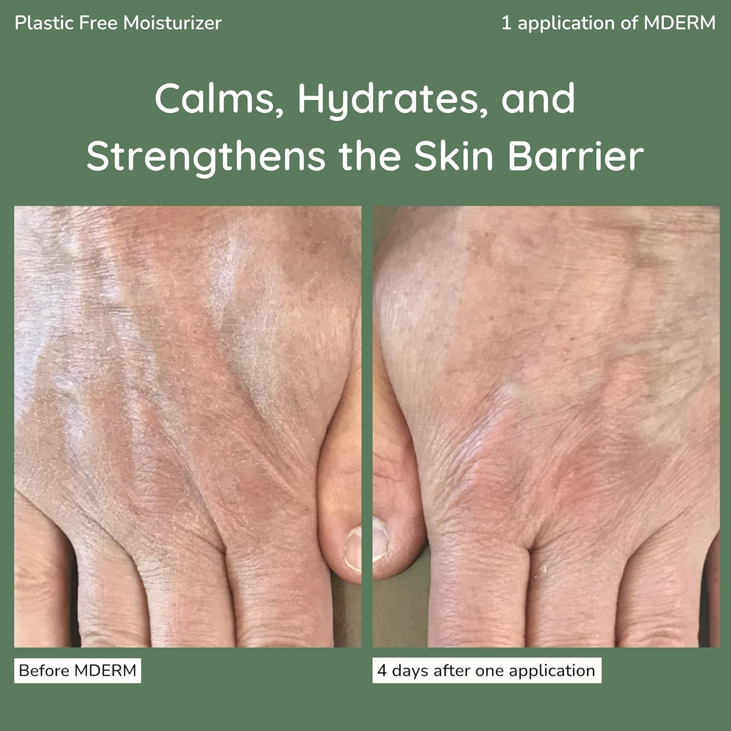 Hidratante Corporal MDERM de Moringa 113.4 g para Piel Seca